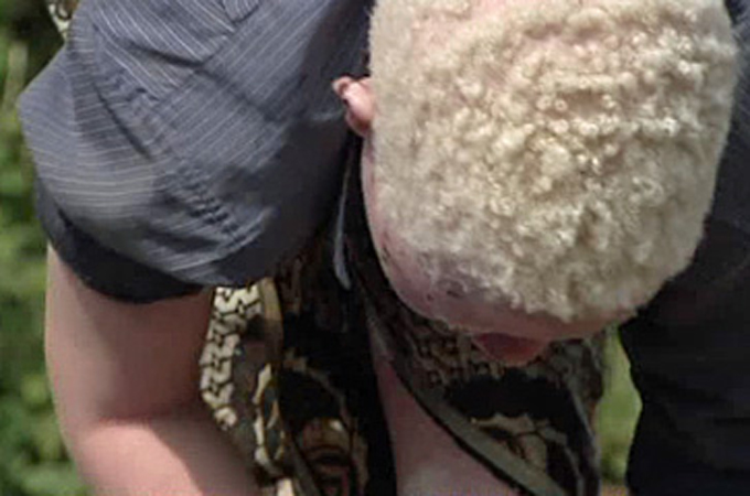 Africa investigates - Tanzania: Spell of Albino