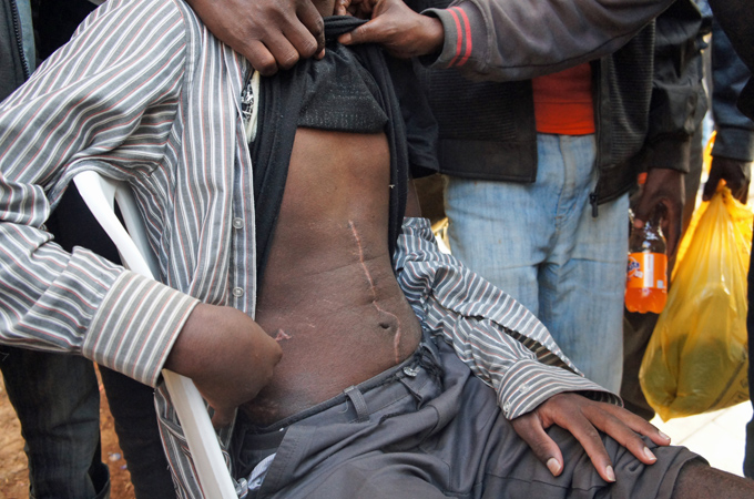 Ahmed woke up in a Riyadh hospital with his kidney removed [Rachel Maher/Al Jazeera]