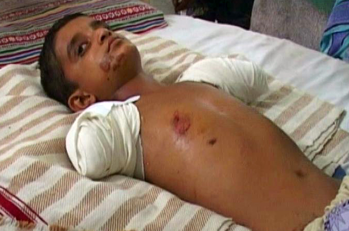 The 10-year-old was punished by a landlord's son after a dispute over an electricity bill [Al Jazeera]