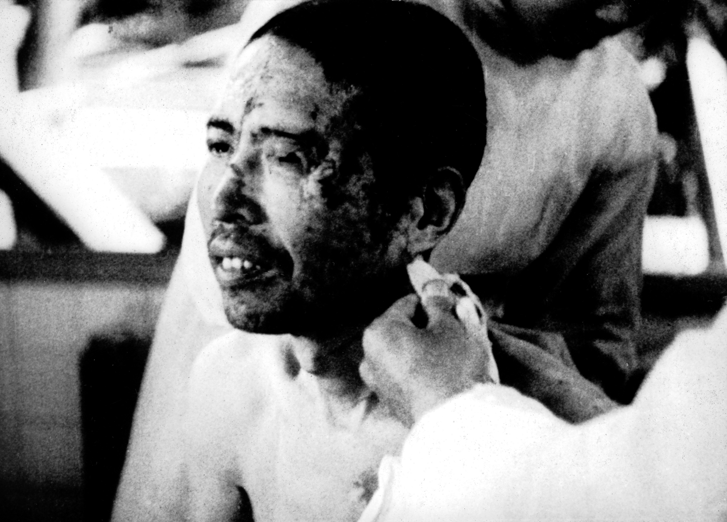 Atomic bomb Hiroshima