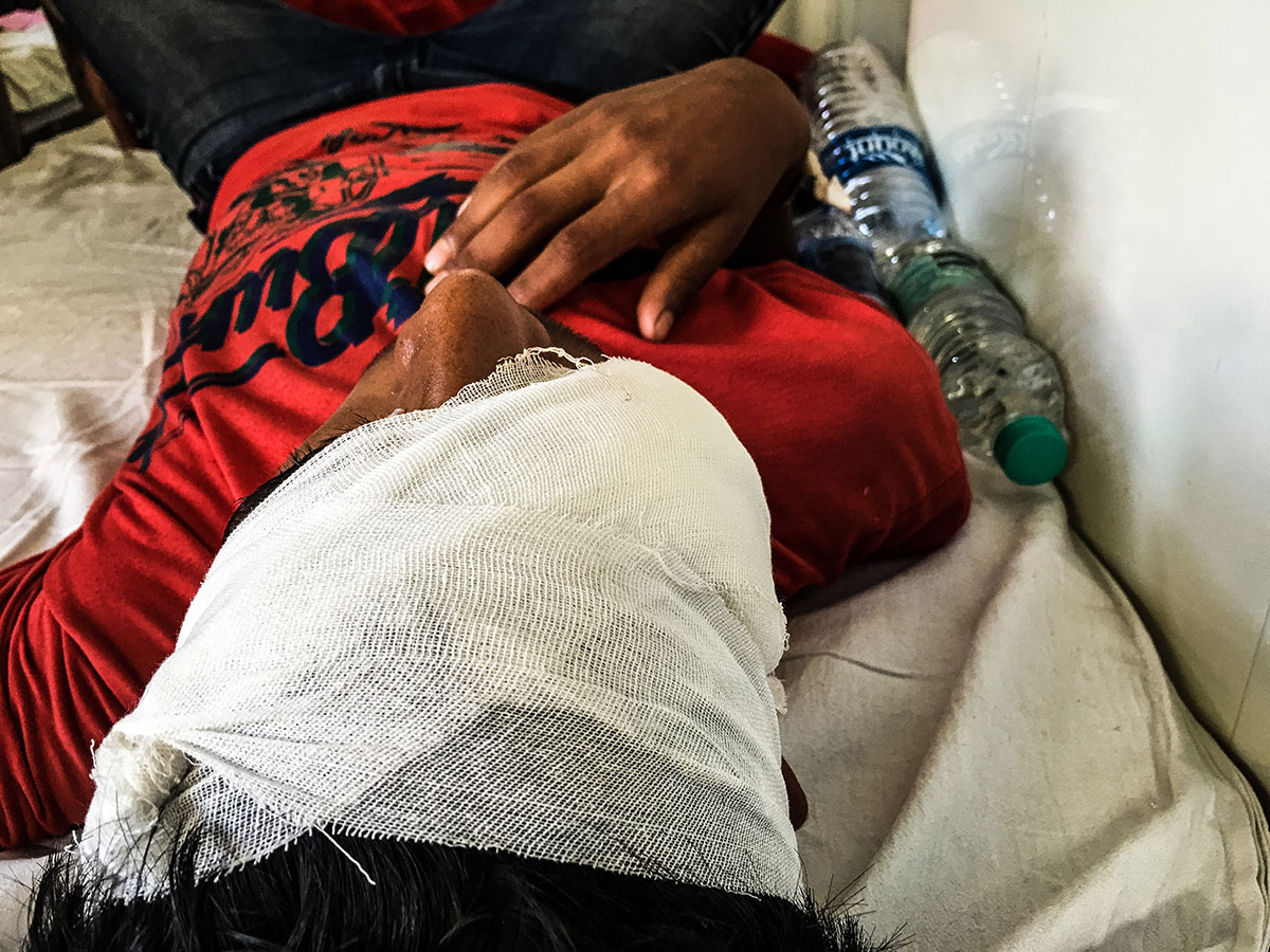 Pellet Injuries/ Please Do Not Use