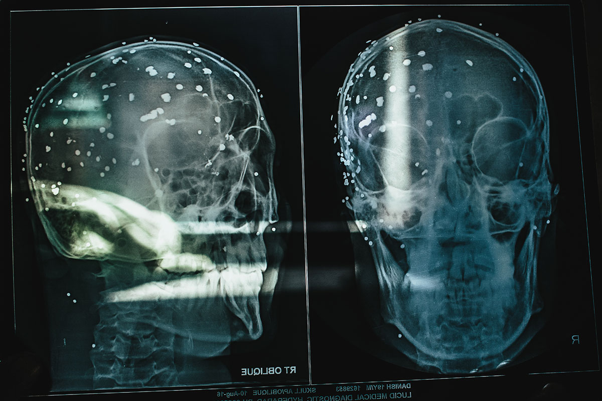 Kashmir Turned blind / Please Do Not Use