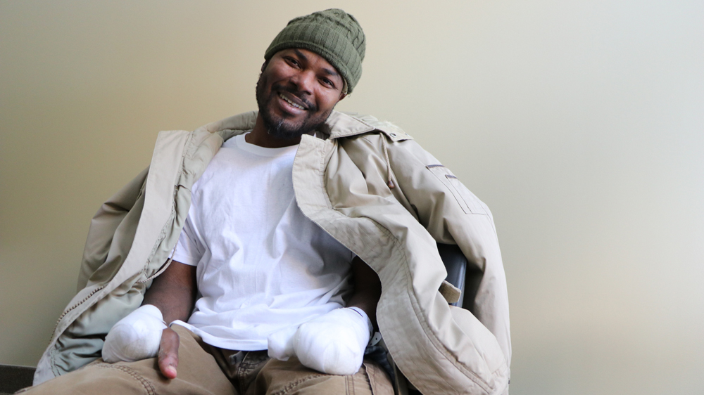 Razak Iyal, a 35-year-old Ghanaian, lost nearly all the fingers on both his hands to frostbite crossing into Canada [Geraldine Malone/Al Jazeera]