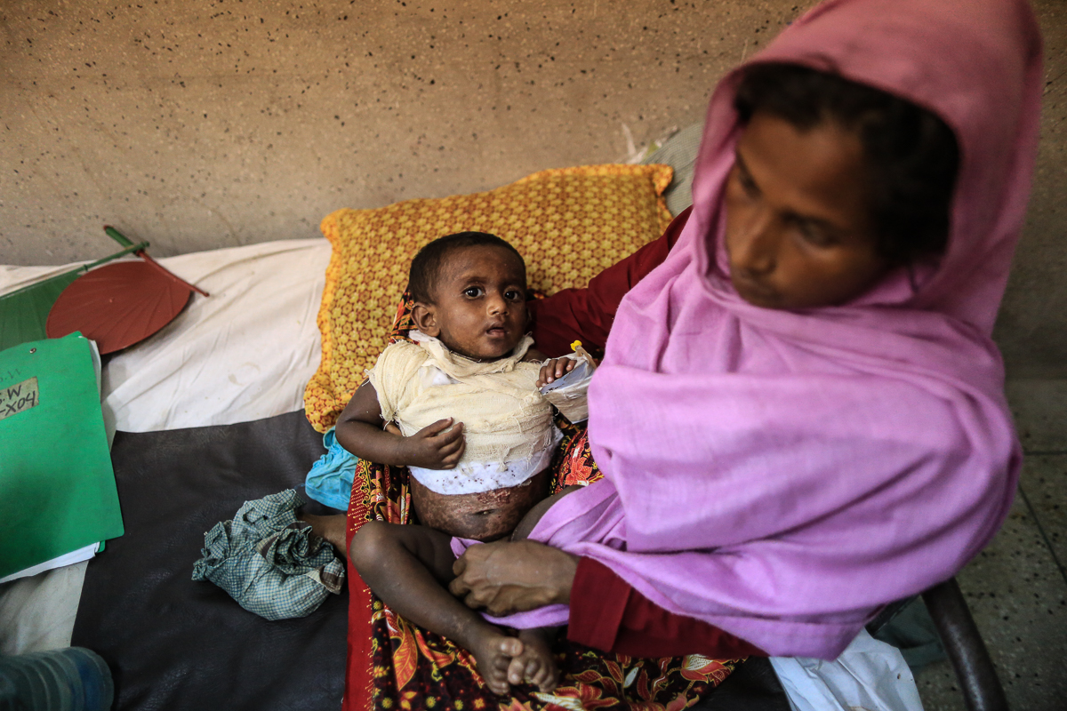 Suffering from severe burns, Mohammad Haris lies in the the lap of his mother, Khursheeda Begum. They are from Thami, Buchidong District. Khursheeda''s husband and 5 children are missing. They lost ea