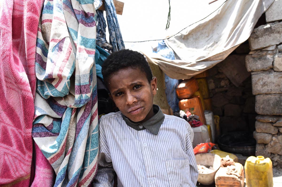 Yemen’s manmade hell /Please Do Not Use