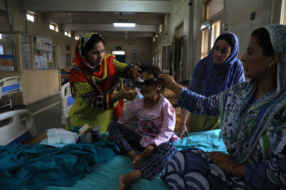 Family membersAttendMunifaNazir 6, years old girl from safakadal area at SMHS hospital in Srinagar on August 17, she was hurt in right eye after paramilitary forces targeted her with a sling shot in