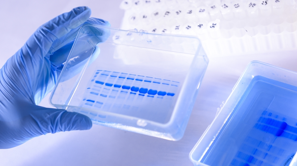 The Technological Vaccine Center of the Federal University of Minas Gerais is Testing a Vaccine against the Coronavirus (COVID - 19) and also Testing Diagnosis Kits