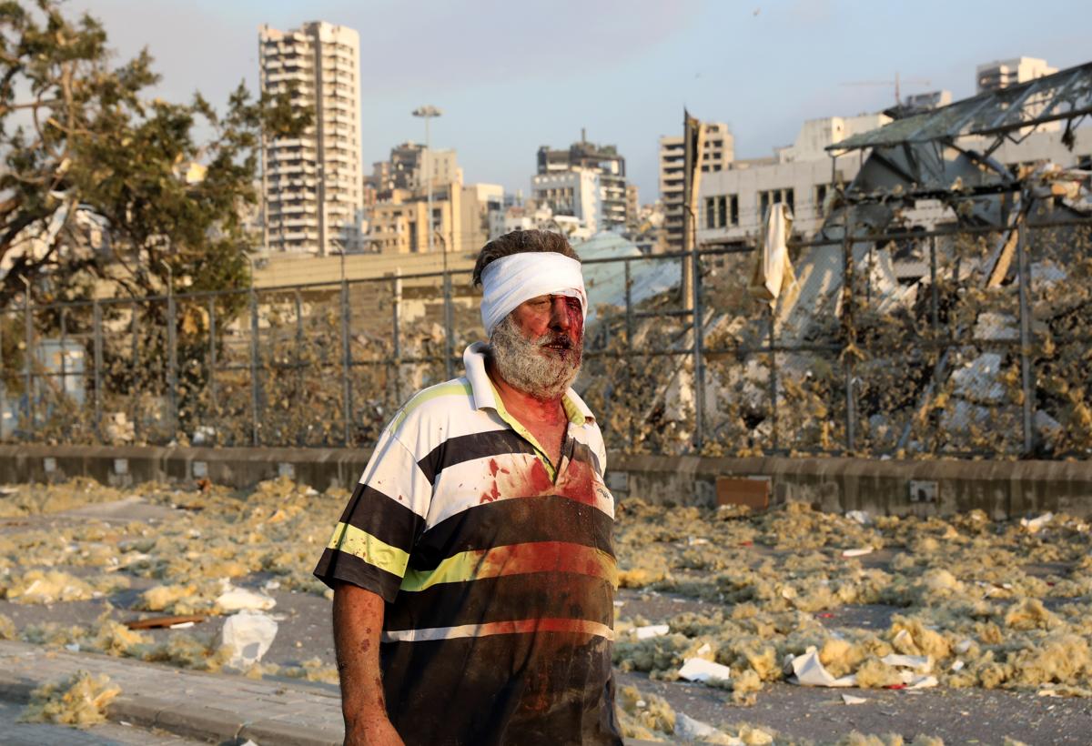 A wounded man walks near the scene of an explosion in Beirut on August 4, 2020. - A large explosion rocked the Lebanese capital Beirut on August 4, an AFP correspondent said. The blast, which rattled
