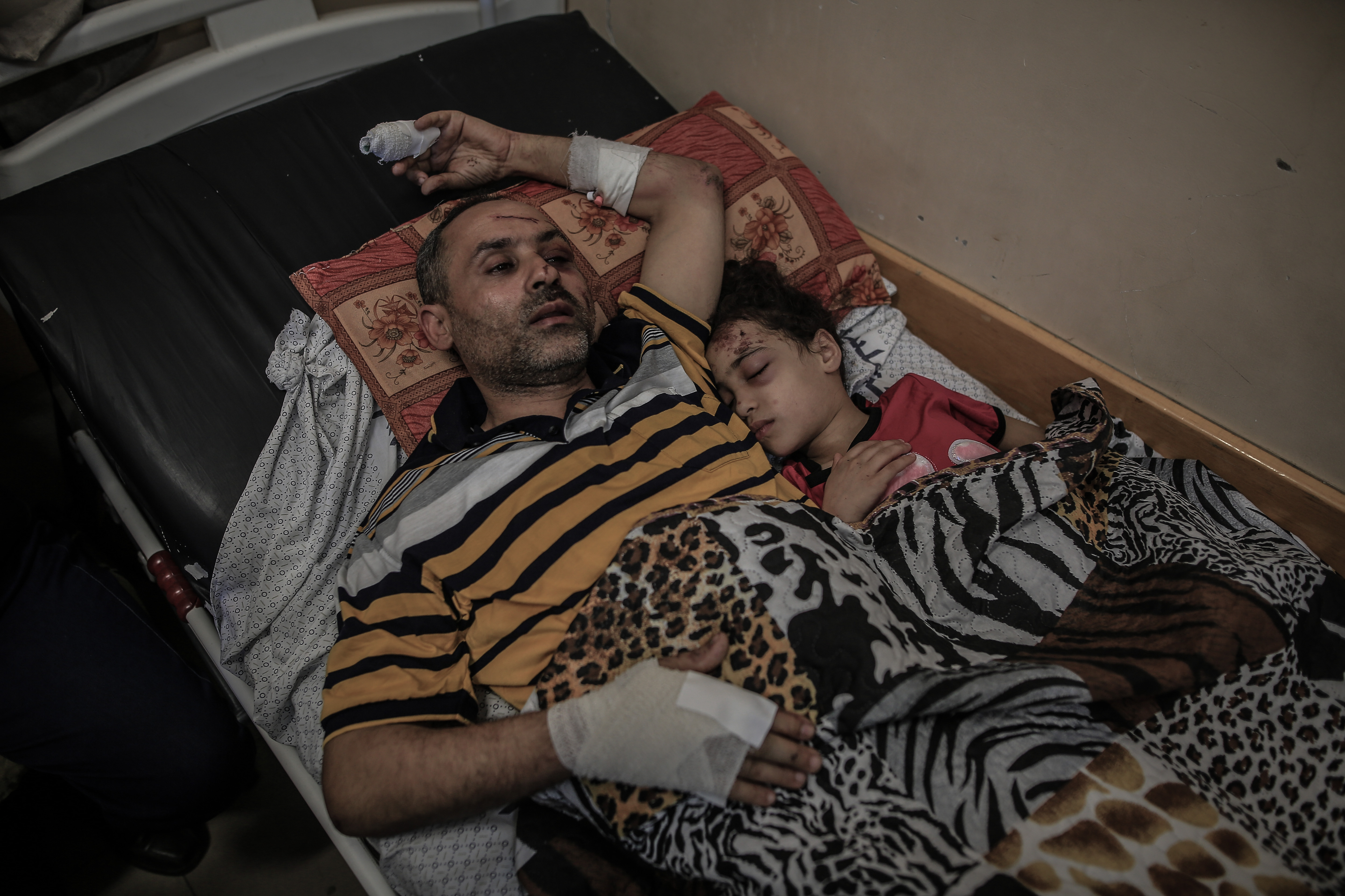 Riyad Eshkontana, 37, and his seven-year-old daughter recover in al-Shifa hospital after they were rescued from the rubble following an Israeli air attack that killed the rest of their family [Sanad Latifa/Al Jazeera]
