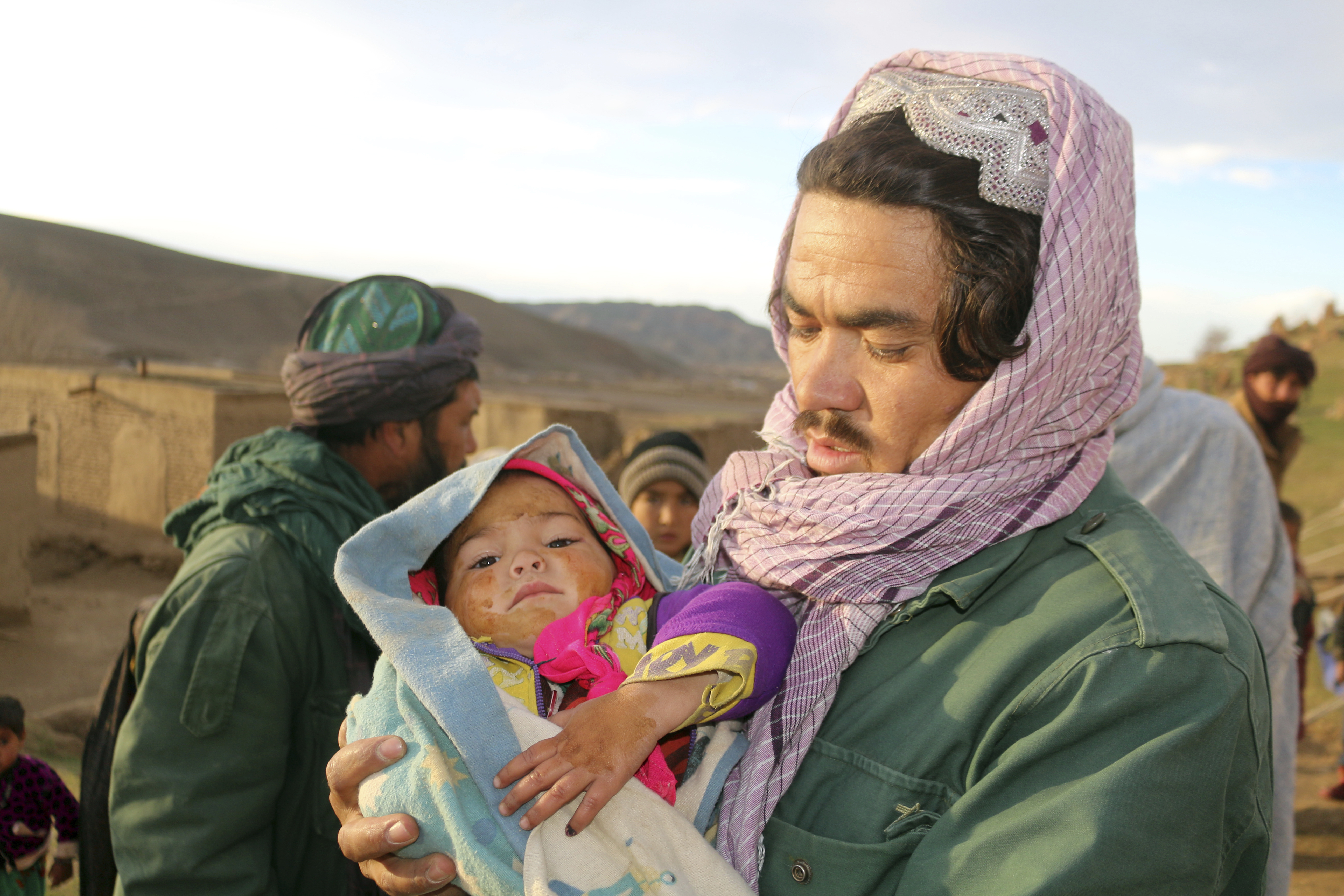 An Afghan man hold his injured daughter after his home was damaged by earthquake