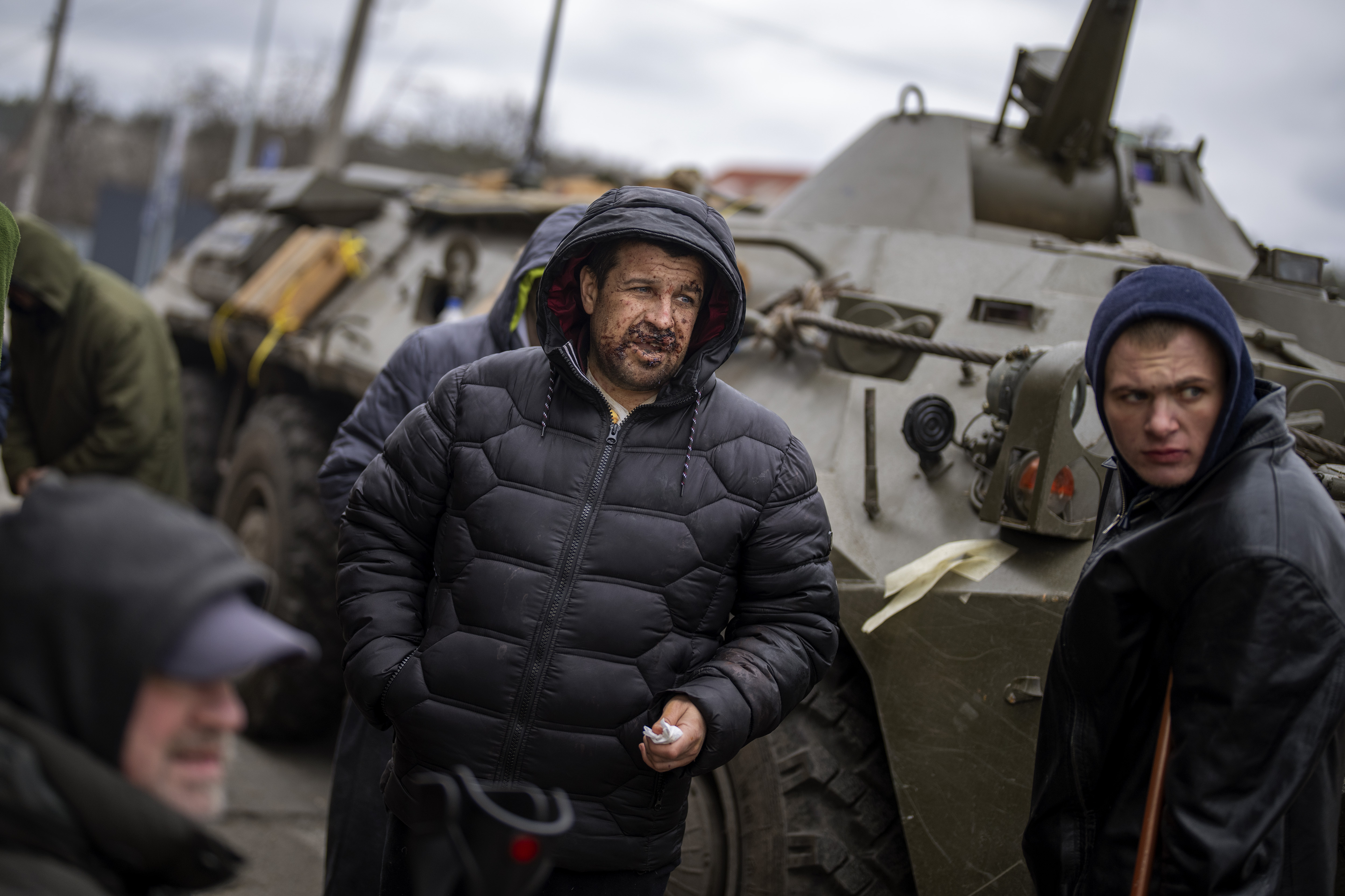 Injured Ukrainian men gather after crossing the Irpin River fleeing the area in the outskirts of Kyiv