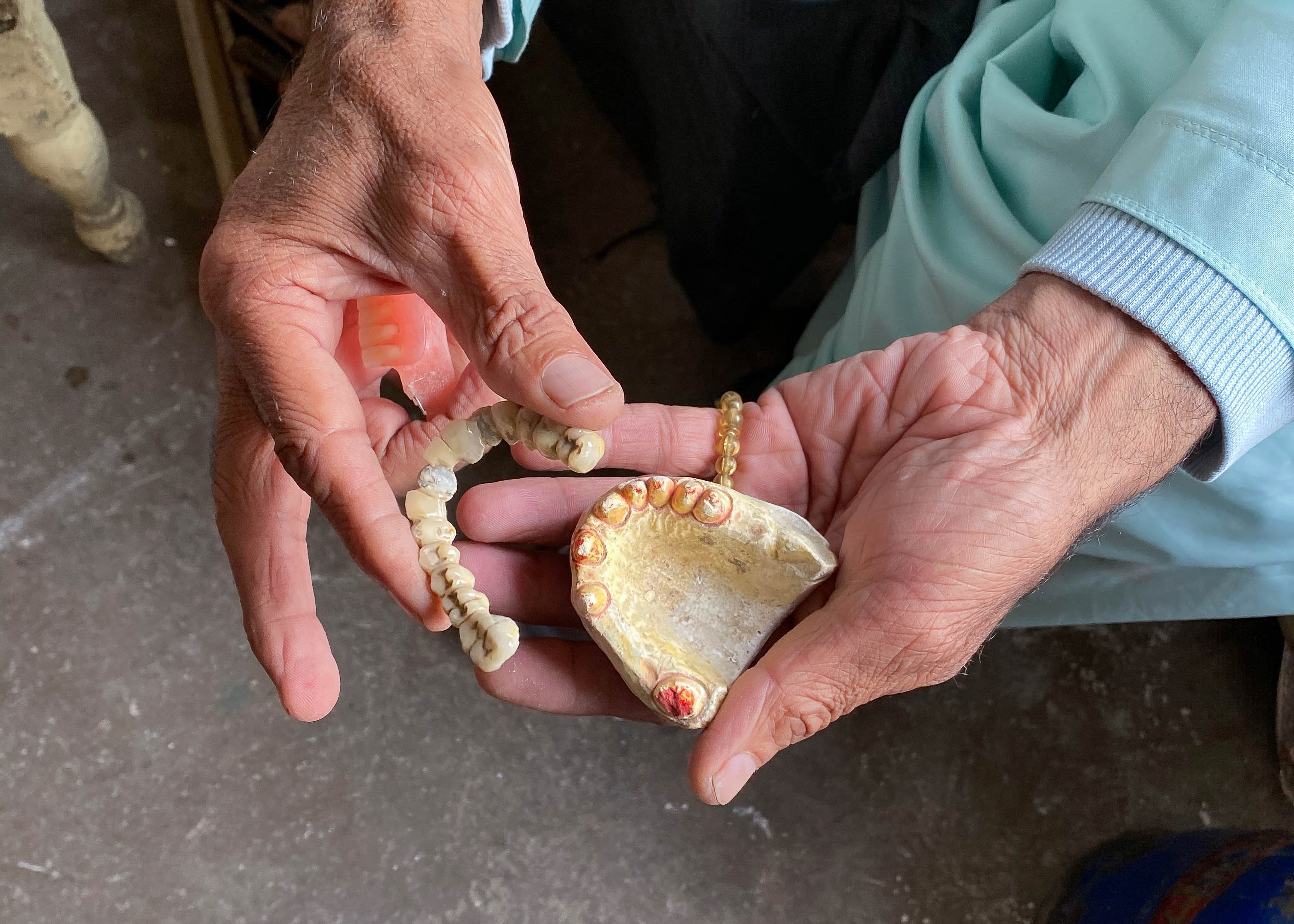 A photo of someone holding a set of sample dentures.