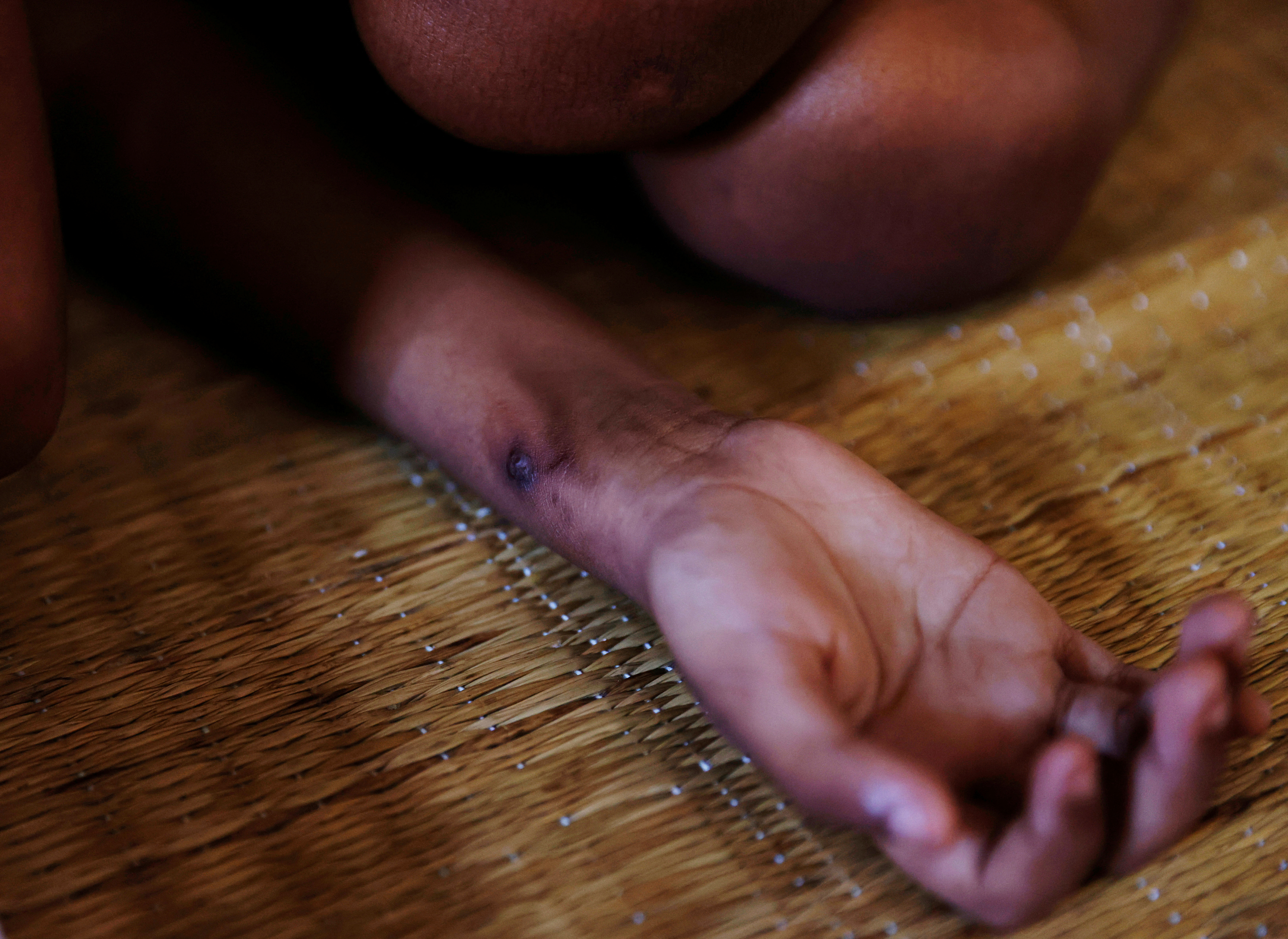 SRI LANKA-CRISIS/HEALTH