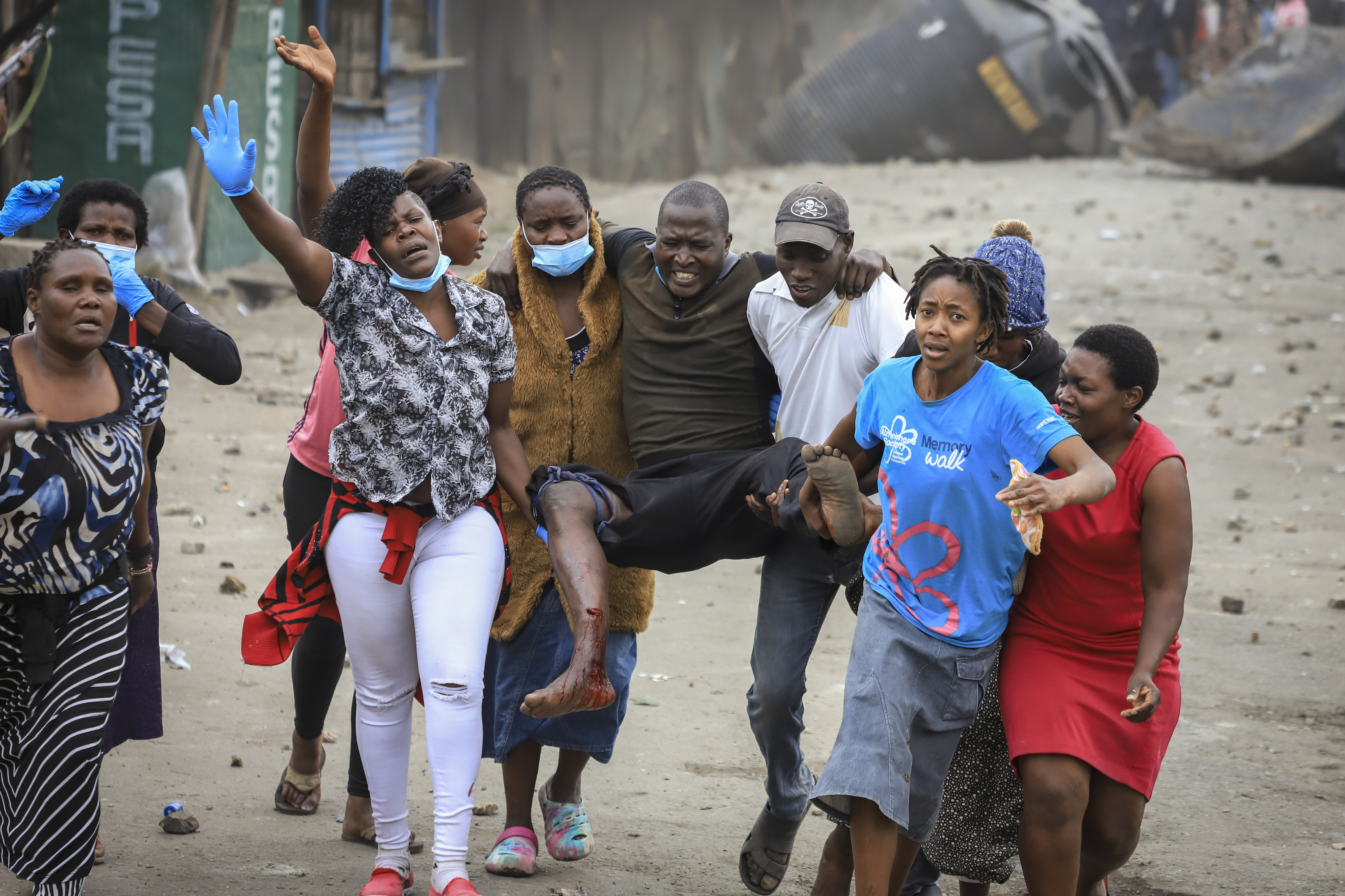 Residents carry a man who they said was wounded in the leg by a stray bullet