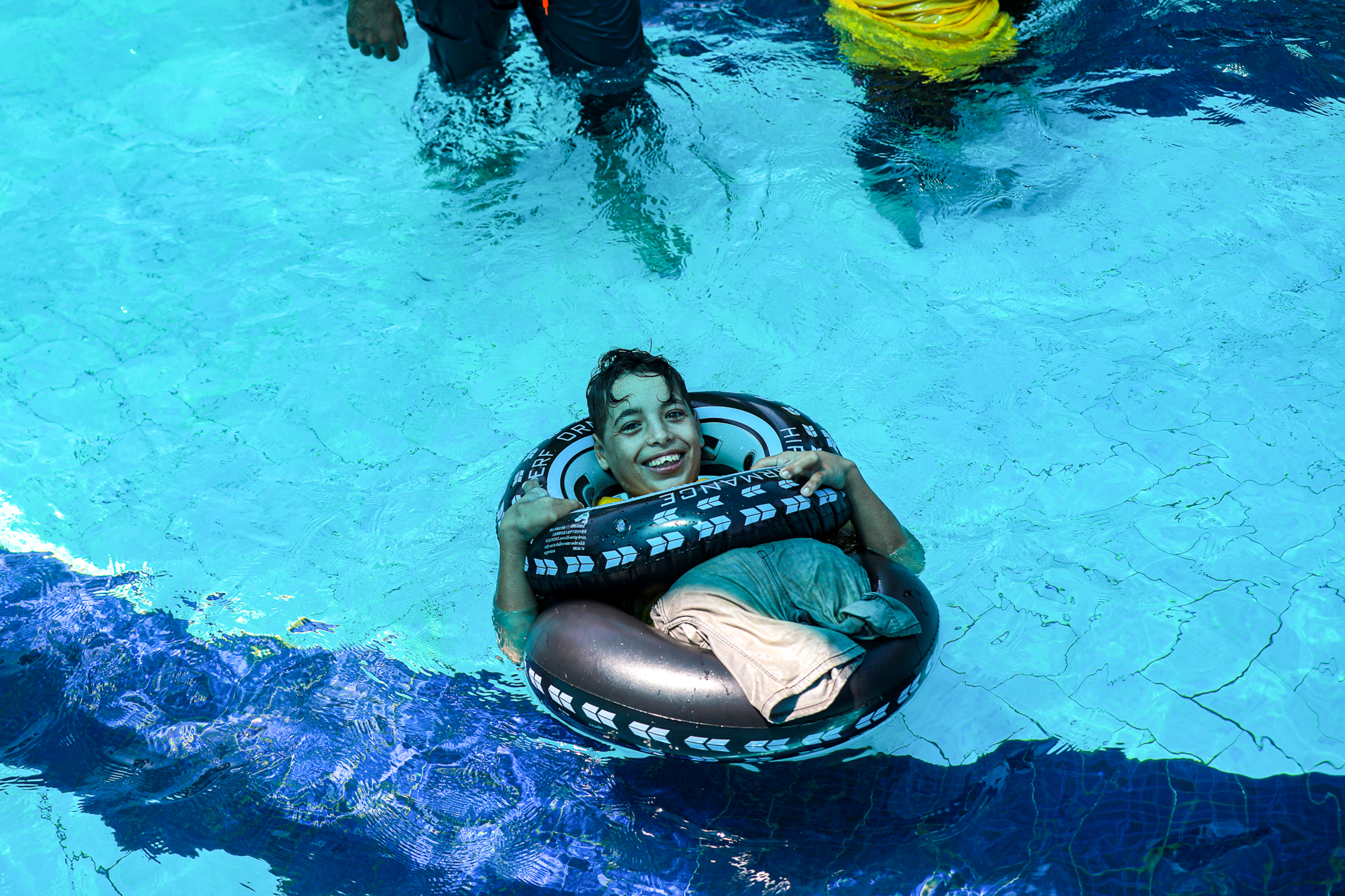 child amputees in Gaza