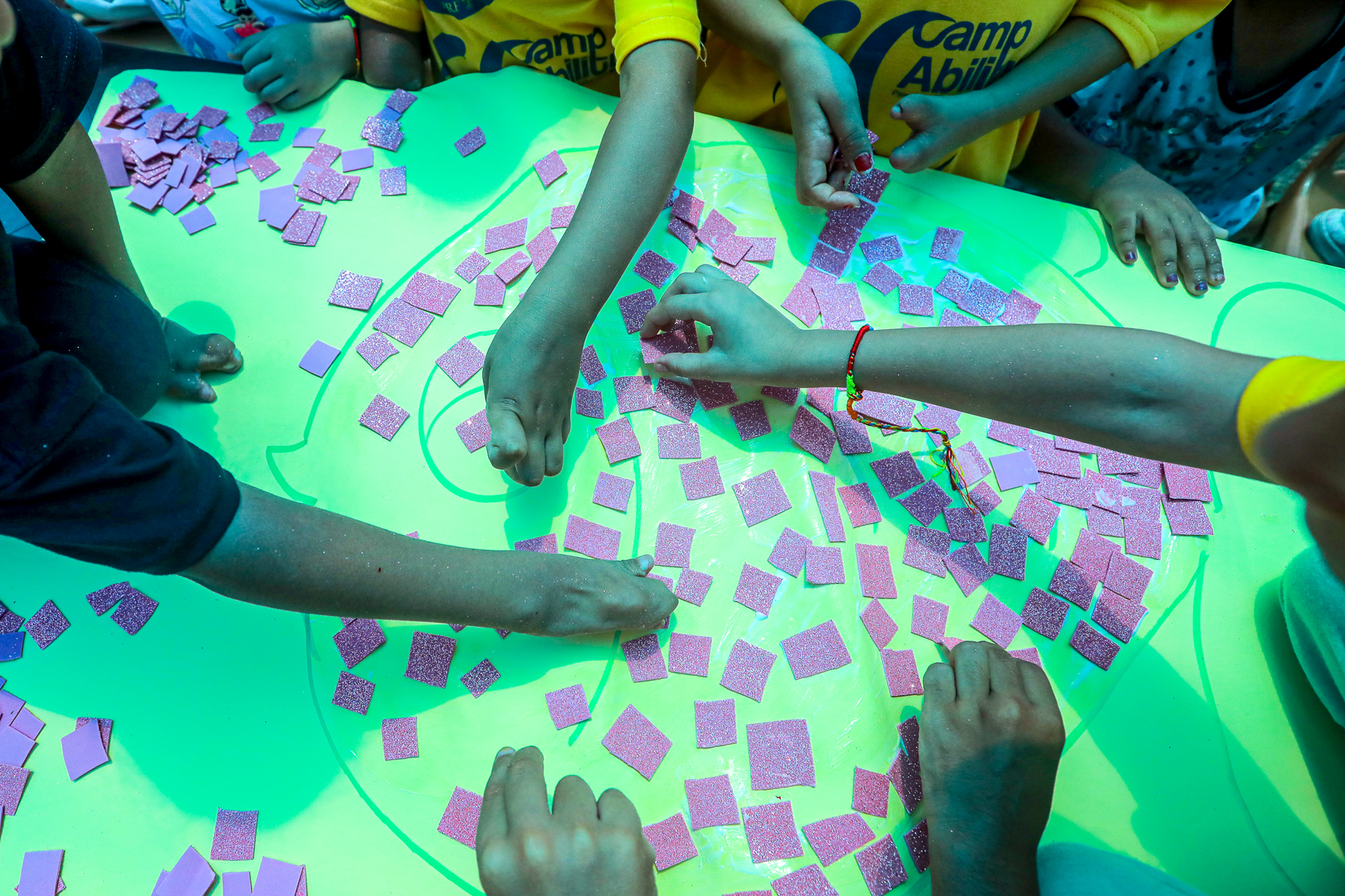 child amputees in Gaza