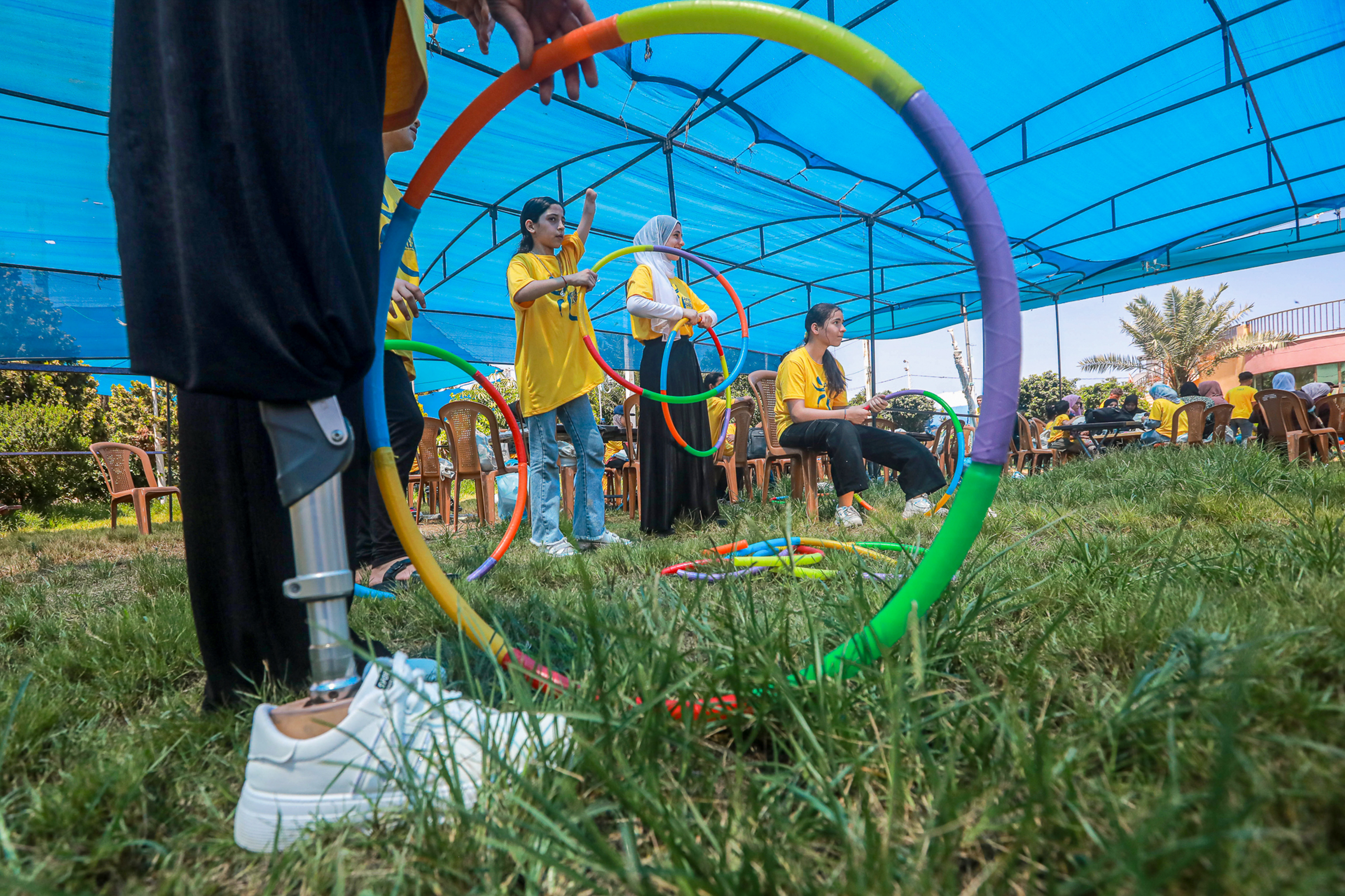child amputees in Gaza