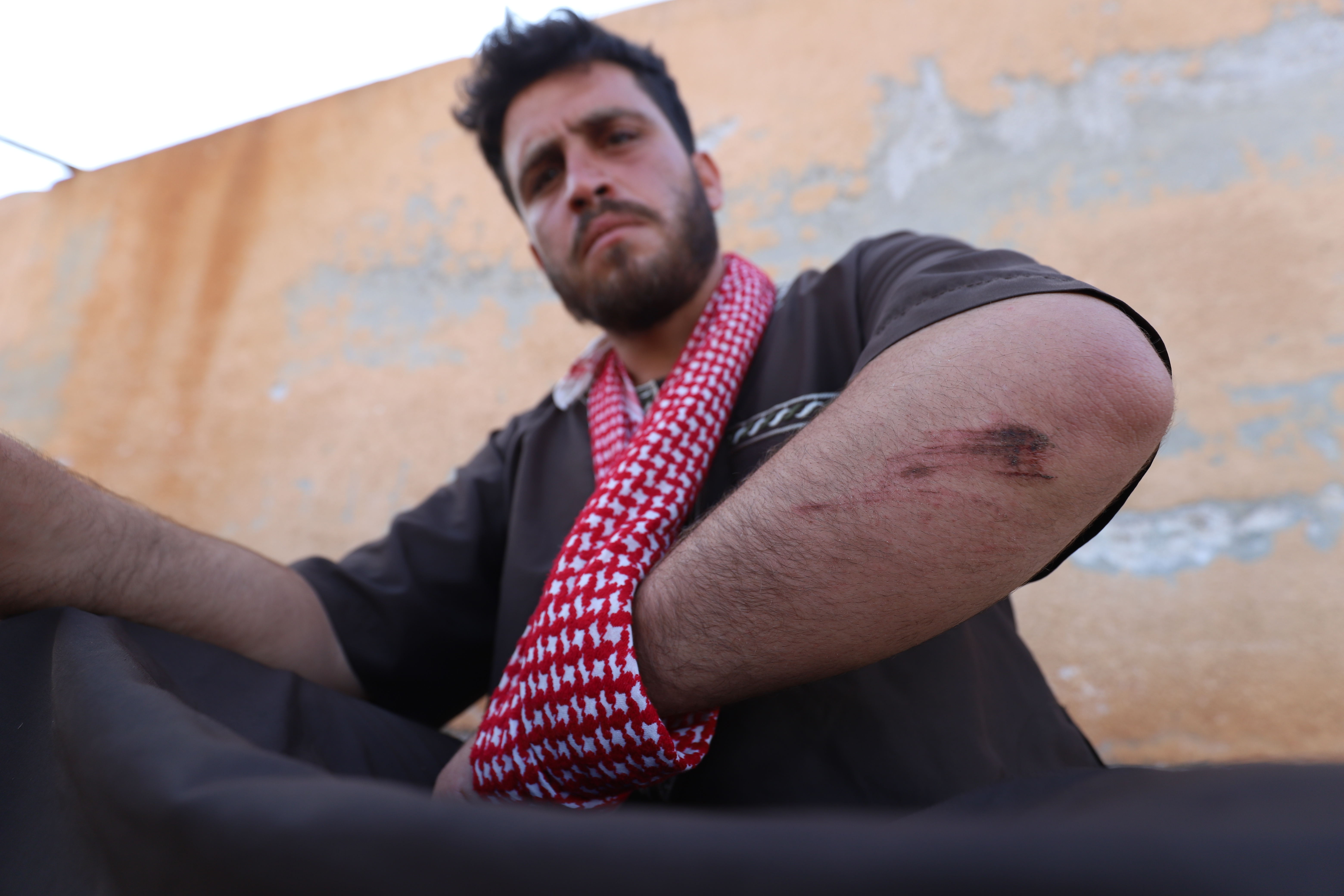 Mohammed al-Khaled, whose father and nephew were killed in Russian attacks, shows his wounded arm