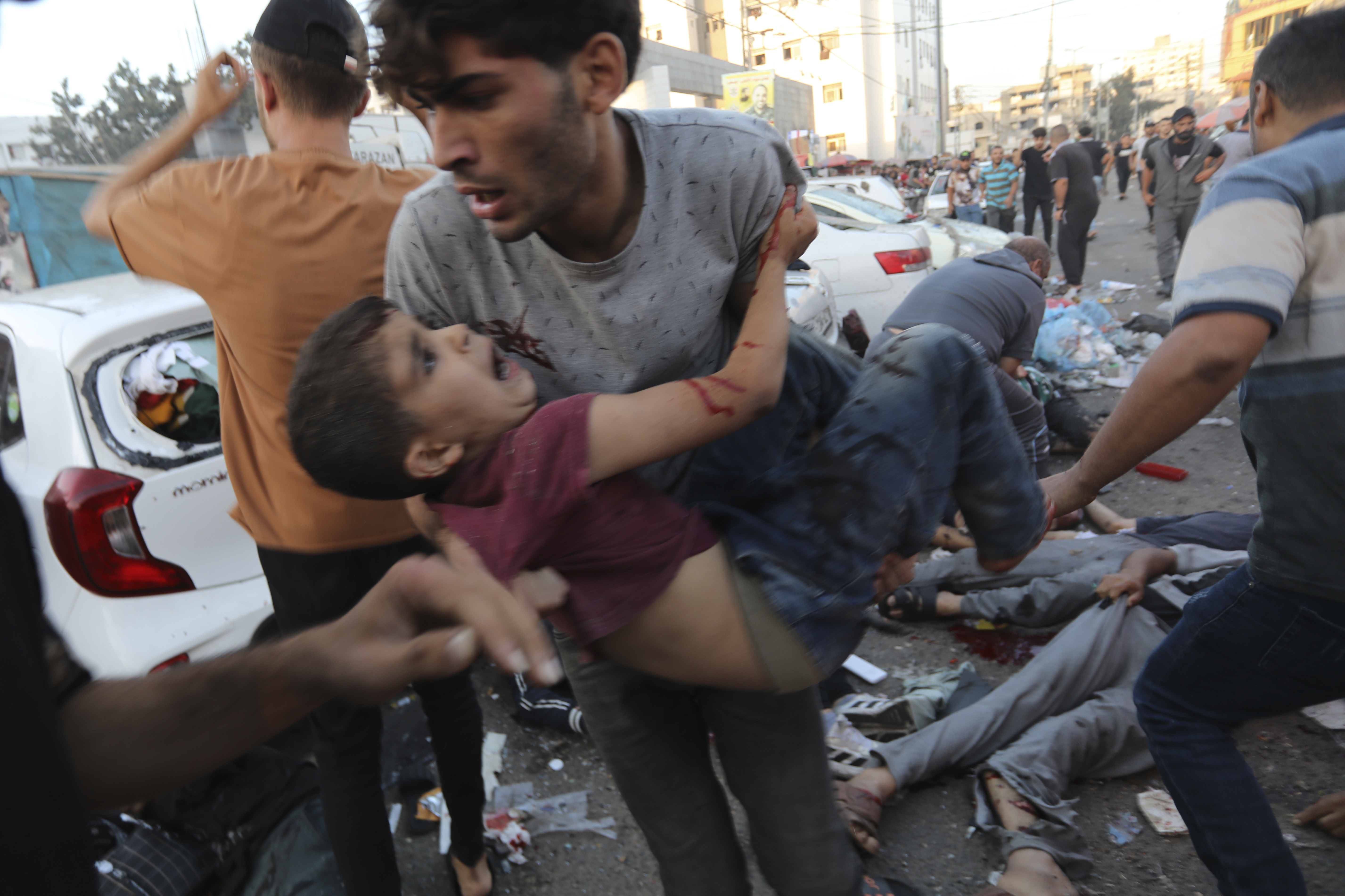 An injured Palestinian boy is carried from the ground following an Israeli airstrike outside the entrance of the al-Shifa hospital in Gaza City