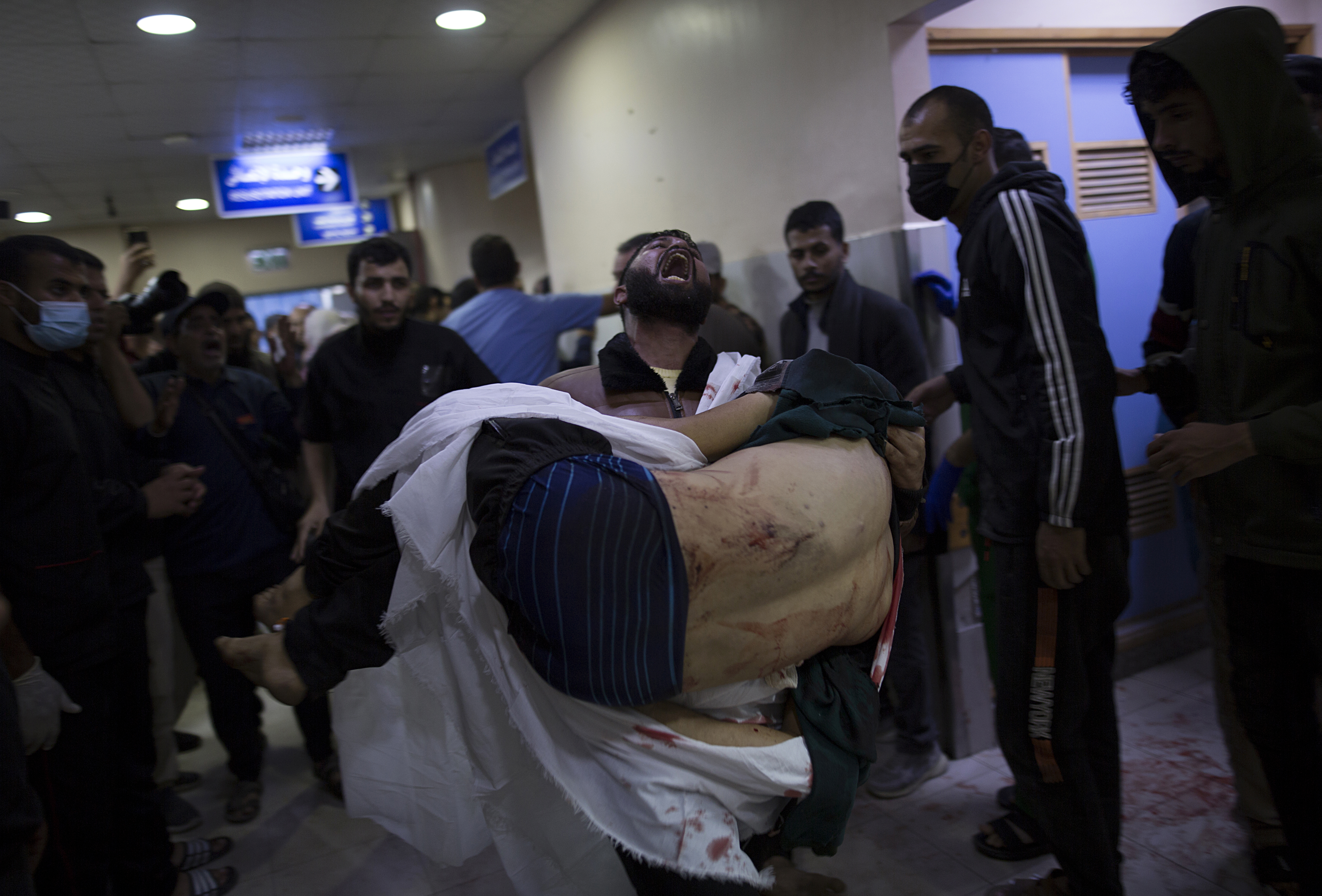 A Palestinian carries a wounded person inside Nasser Hospital in Khan Yunis, southern Gaza Strip, 03 December 2023