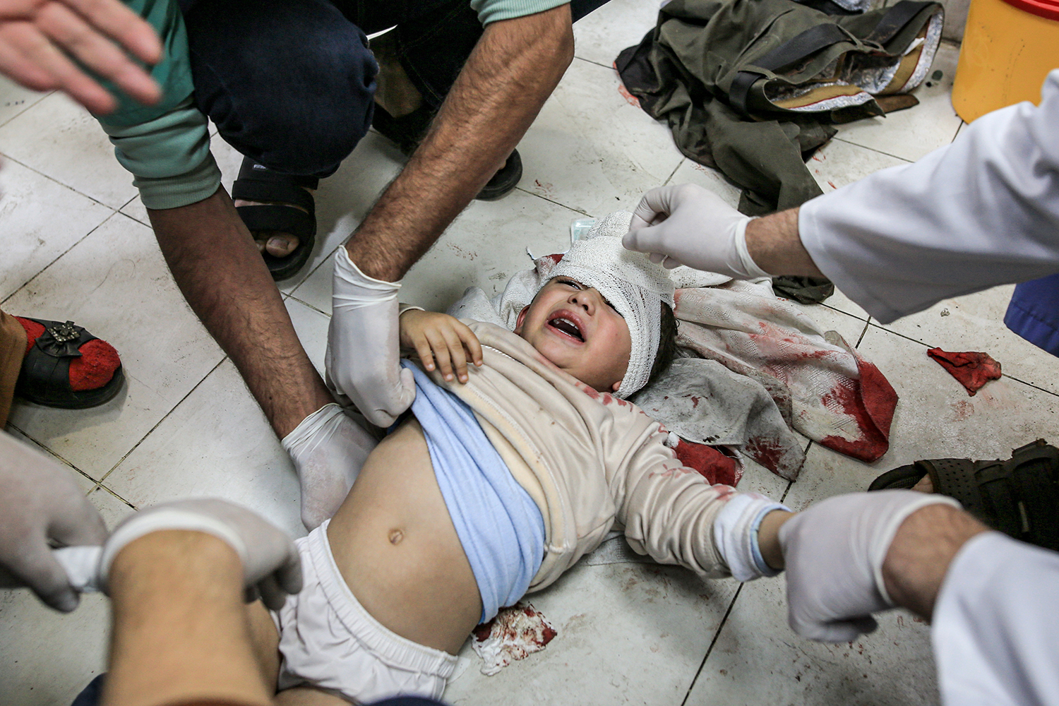 An injured Palestinian child at Nasser hospital