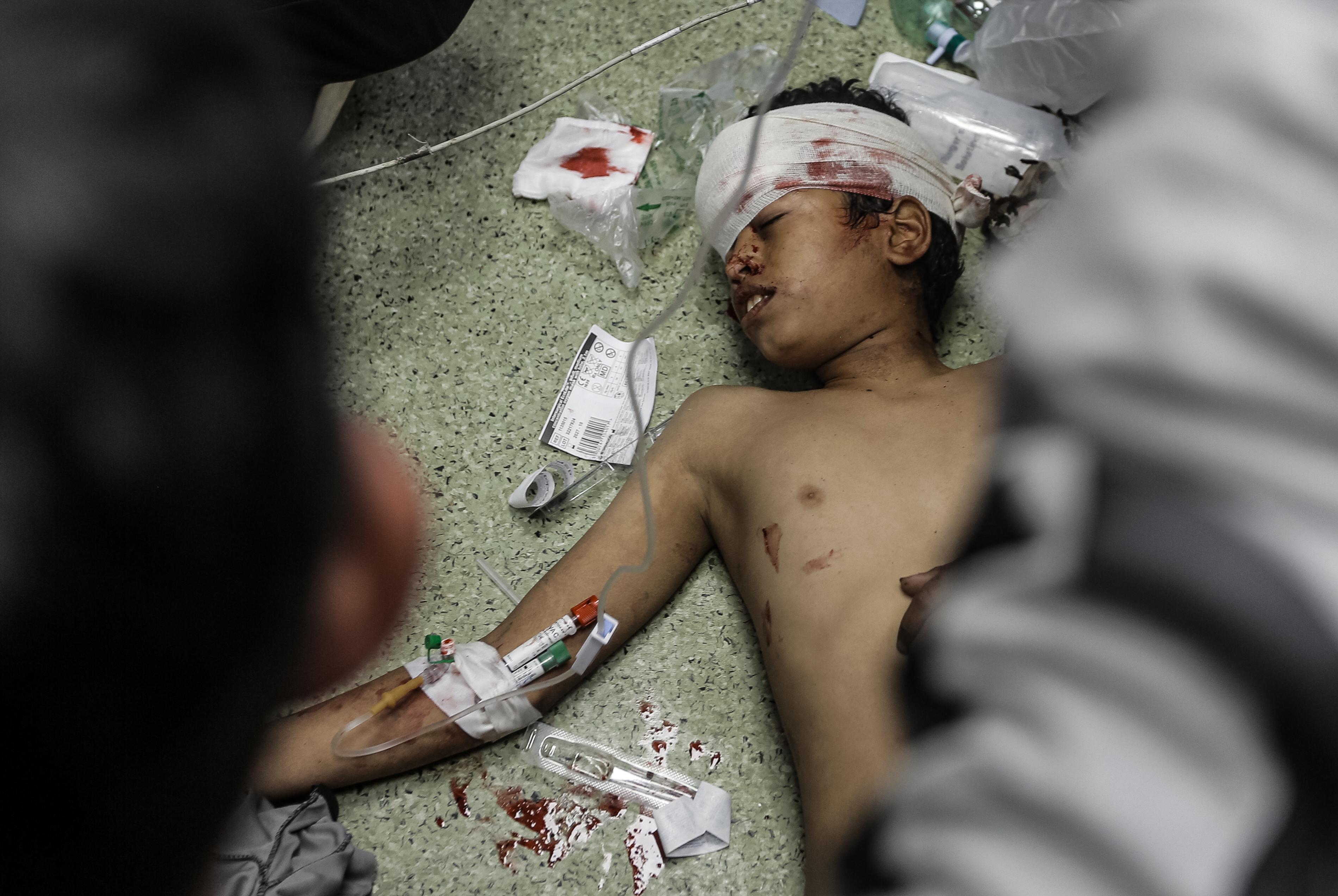Injured boy lies on the ground with a bandage around his head