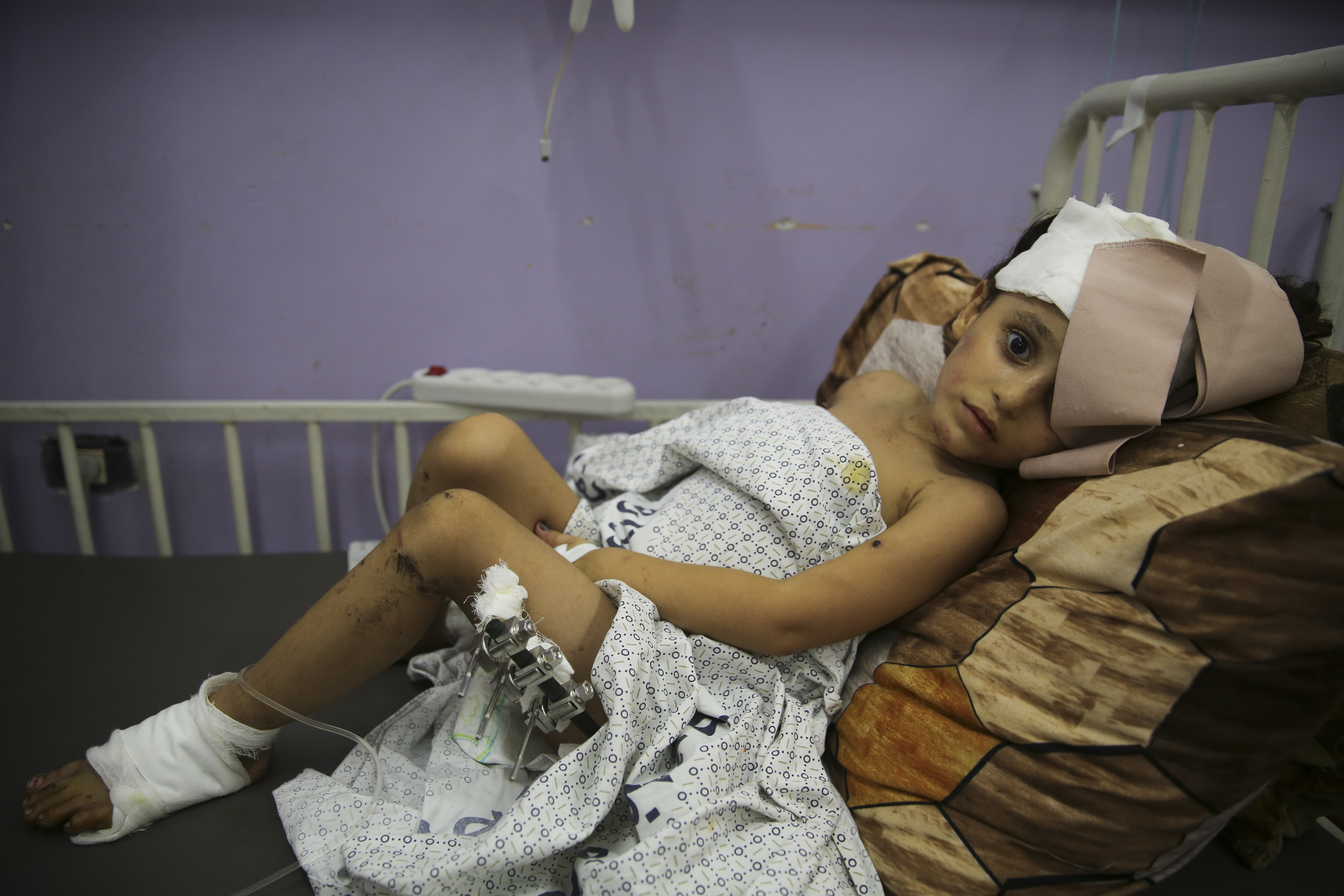 Kenzi al Madhoun, a four-year-old who was wounded in Israeli bombardment, lies at Al Aqsa Hospital