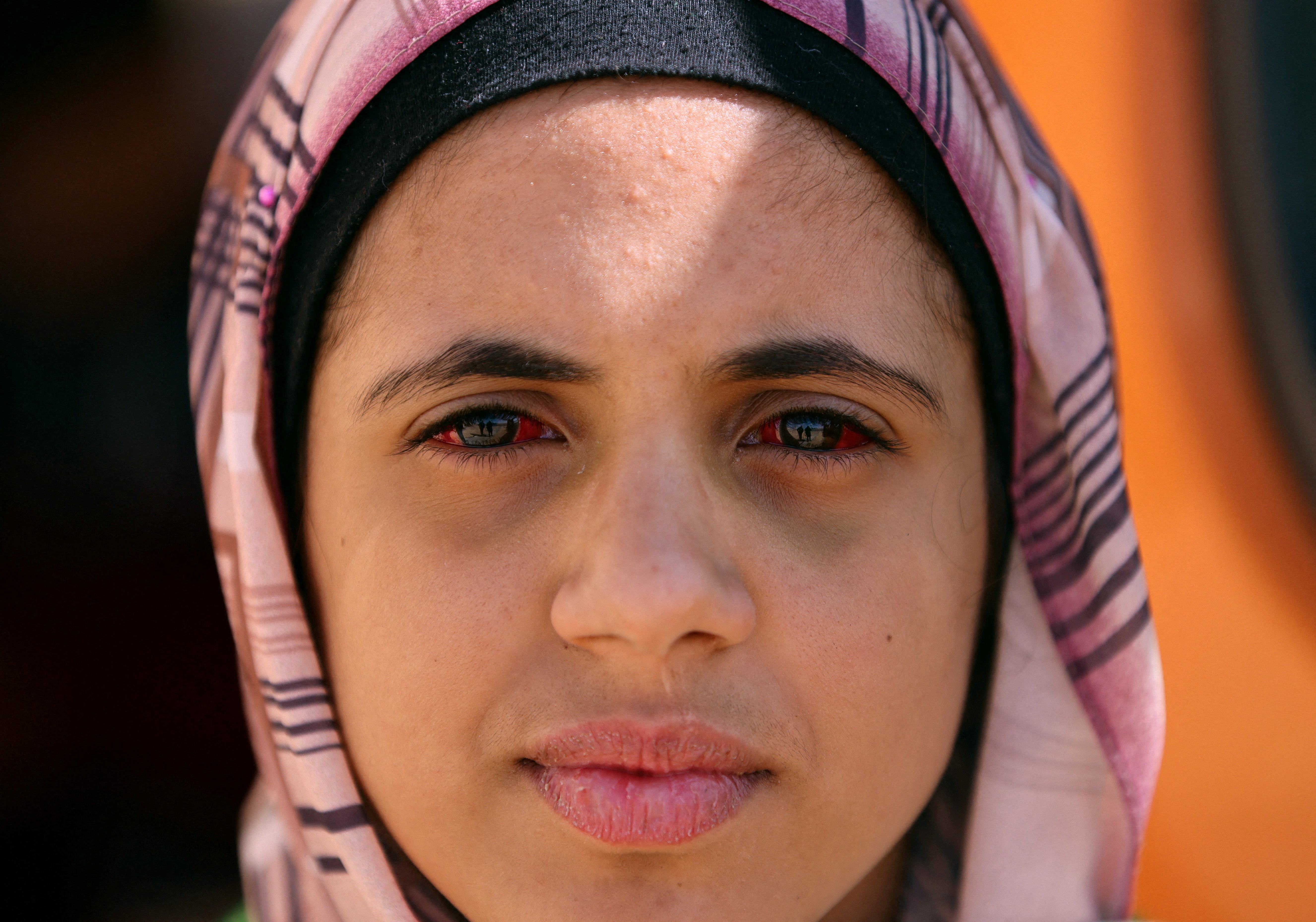 Injured Palestinian girl, Amina Ghanam, looks on as she is evacuated via a Qatari aid plane for treatment in Qatar, amid the ongoing conflict between Israel and Palestinian Islamist group Hamas, at Al Arish Airport, Egypt, February 1