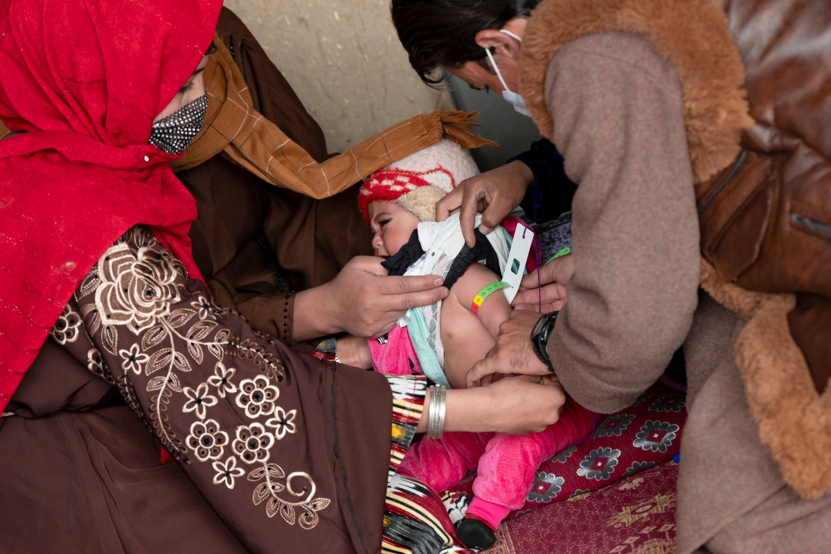 Malnutrition threatens future Afghan generations
