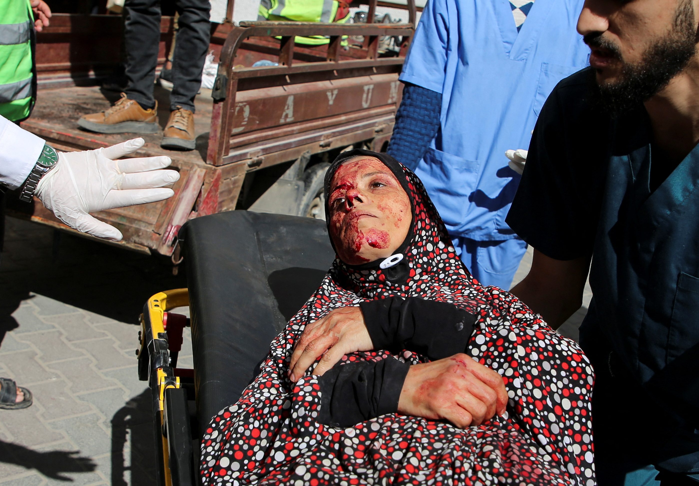A Palestinian woman wounded in an Israeli strike is rushed into a hospital