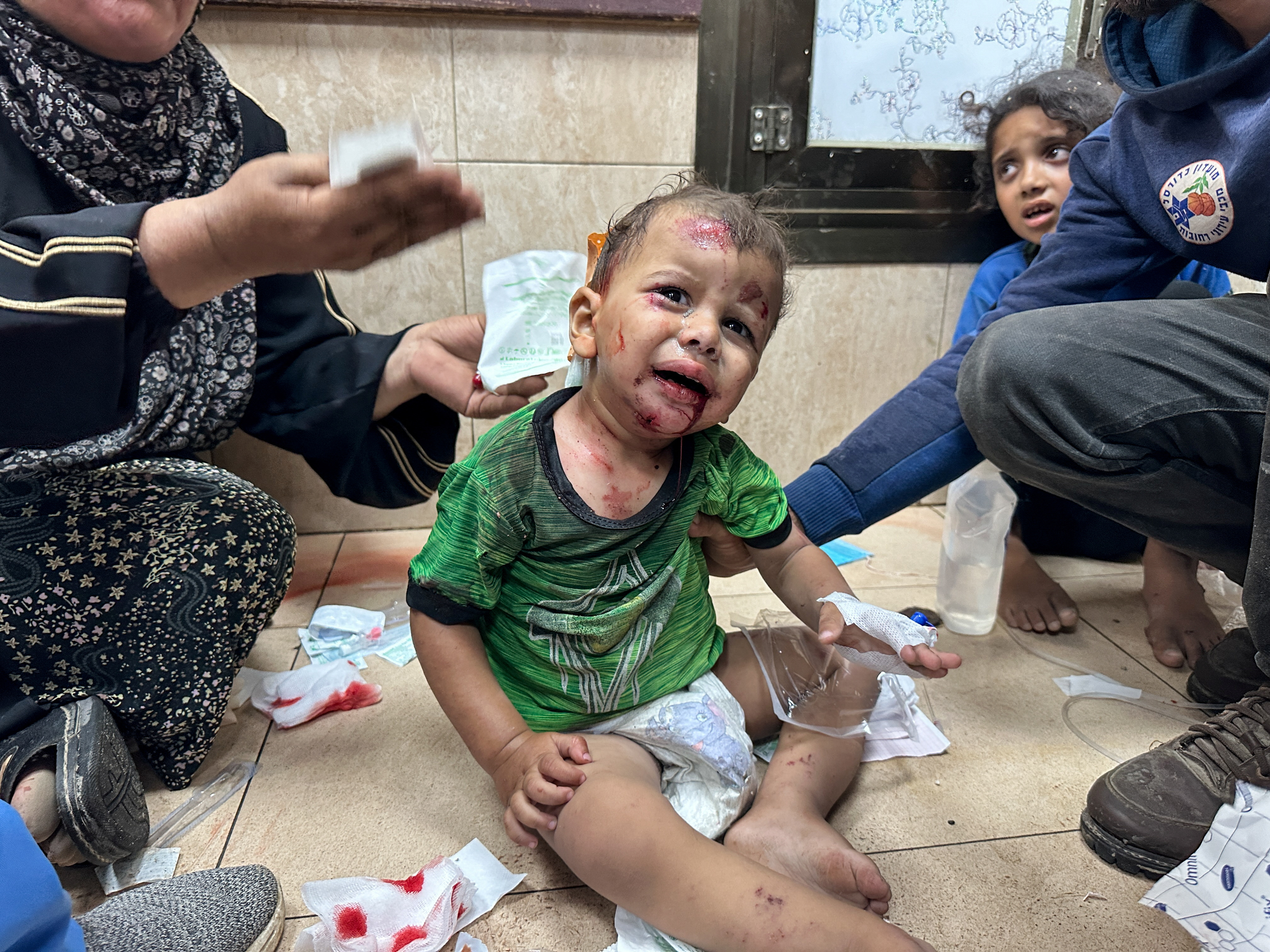 An injured child is assisted at Al-Aqsa Martyrs Hospital, in the aftermath of an Israeli strike, amid the Israel-Hamas conflict, in Deir Al-Balah, in the central Gaza Strip, June 8