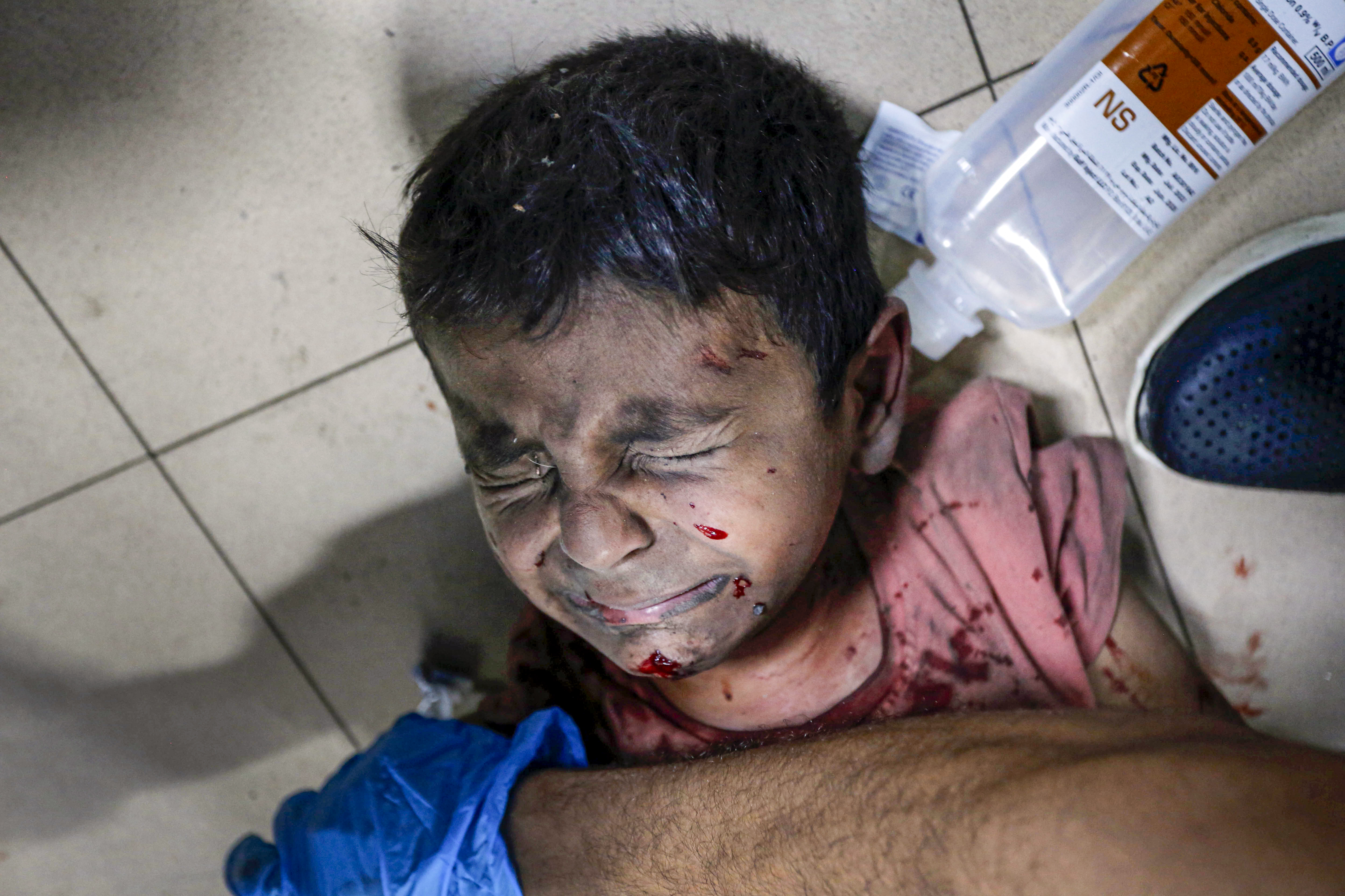 wounded Palestinians