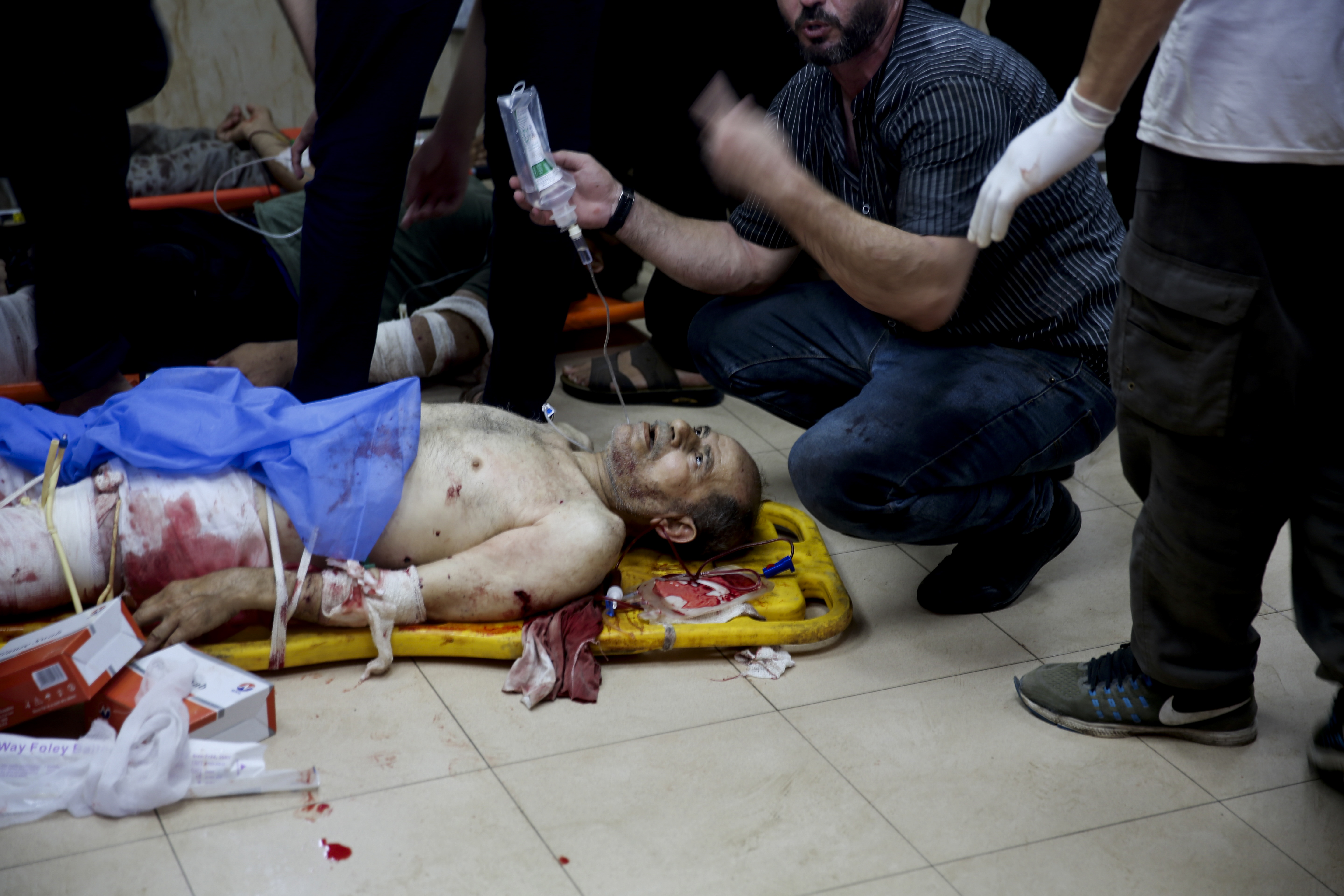 Palestinians wounded in the Israeli bombardment of the Gaza Strip are treated at al-Aqsa Hospital in Deir al Balah on Saturday, June 8