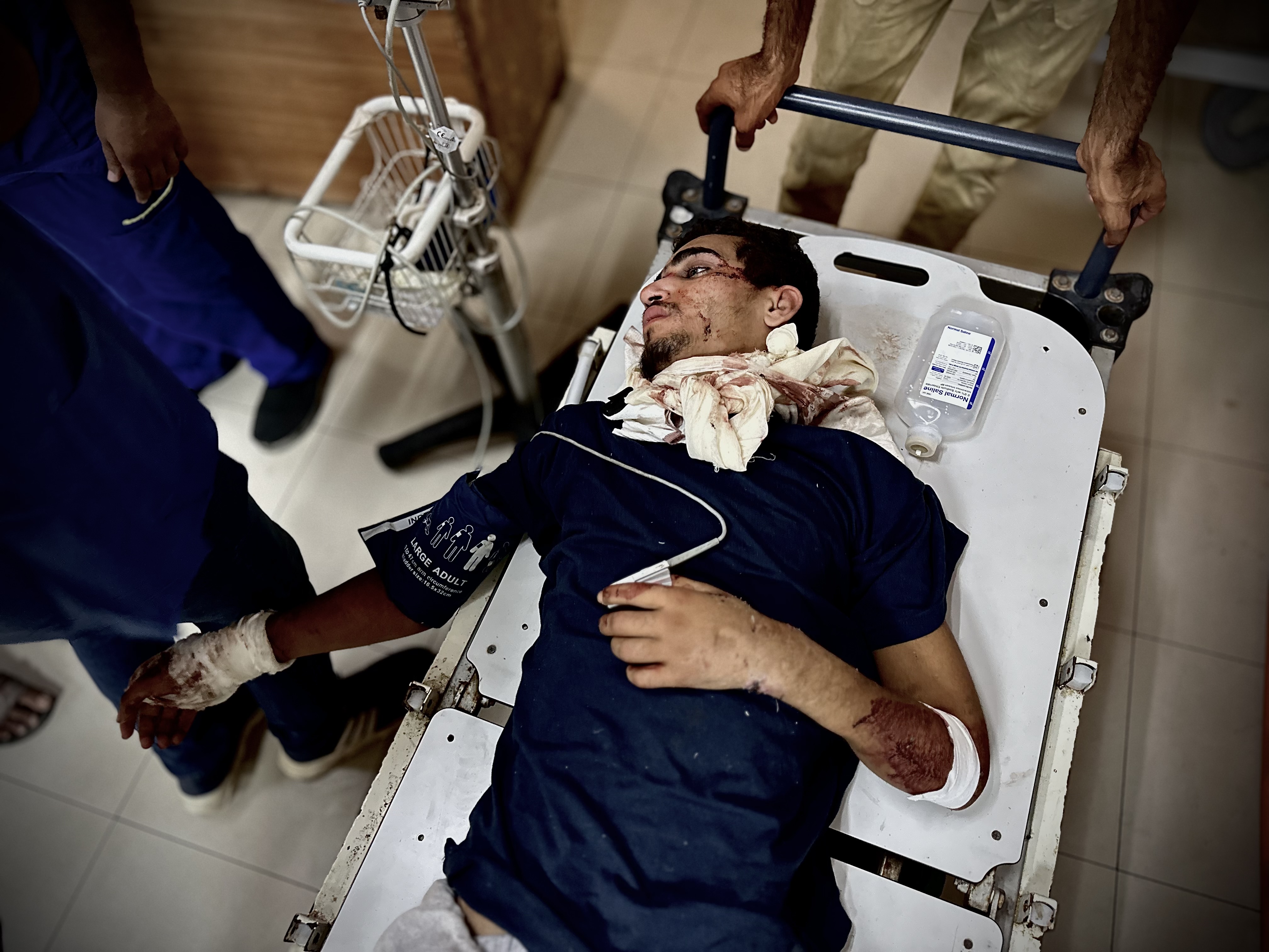 Palestinian prisoners, arrested by Israeli forces, are brought to Nasser Hospital for medical treatment after their health conditions deteriorated in Khan Yunis