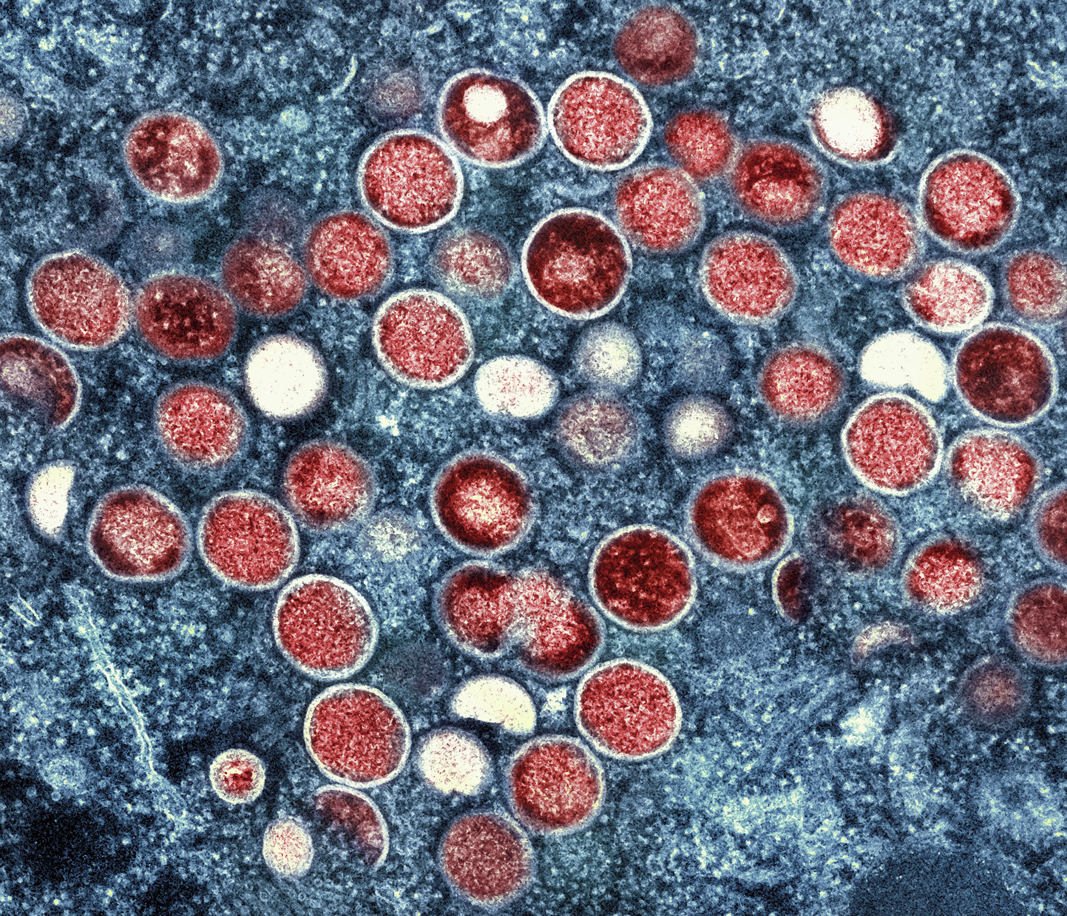 mpox under microscope
