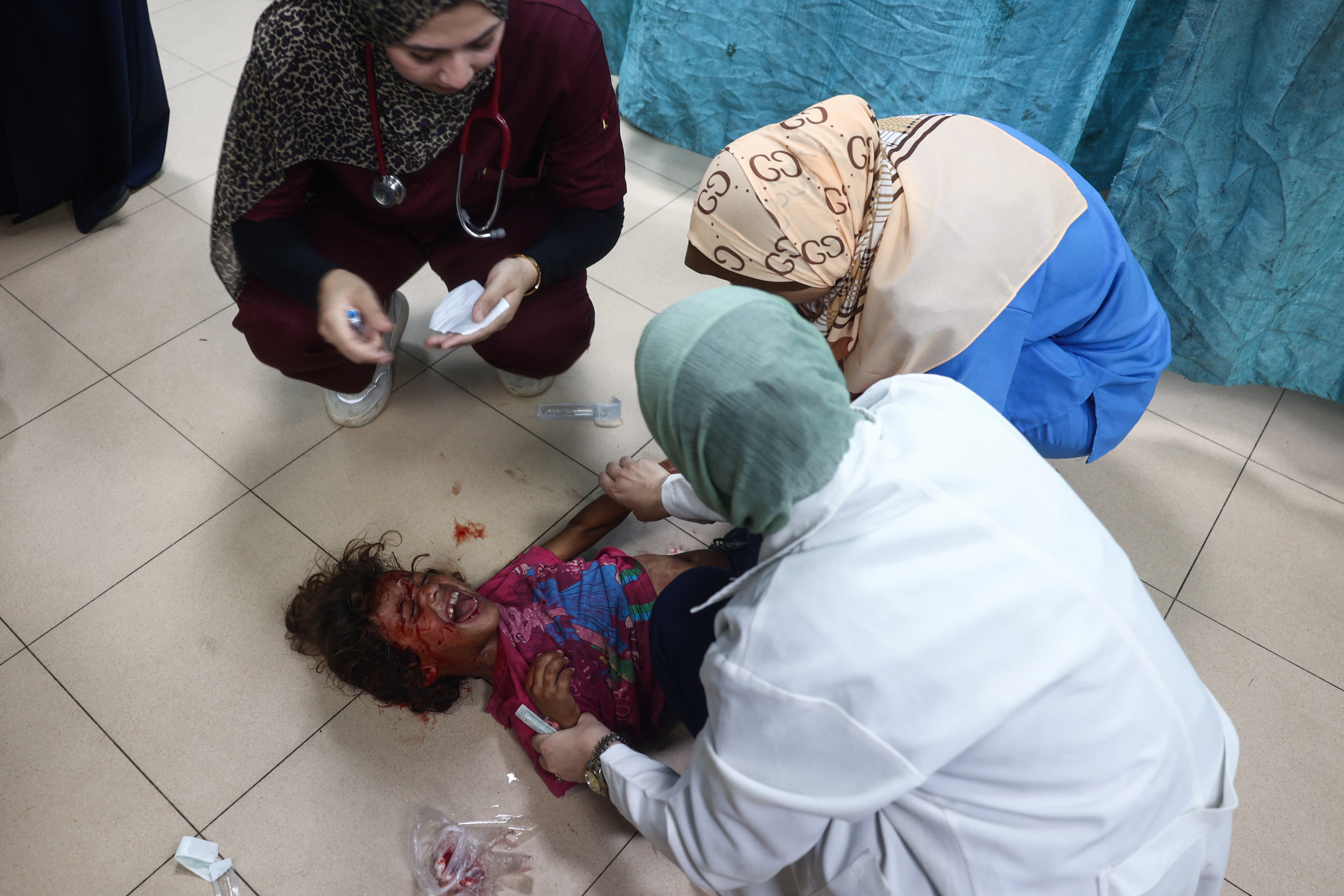 Palestinian medics treat a girl who was injured in Israeli strikes on a displacement camp in the Bureij refugee camp, at the al-Aqsa Martyrs hospital in Deir al-Balah in the central Gaza Strip on October 8