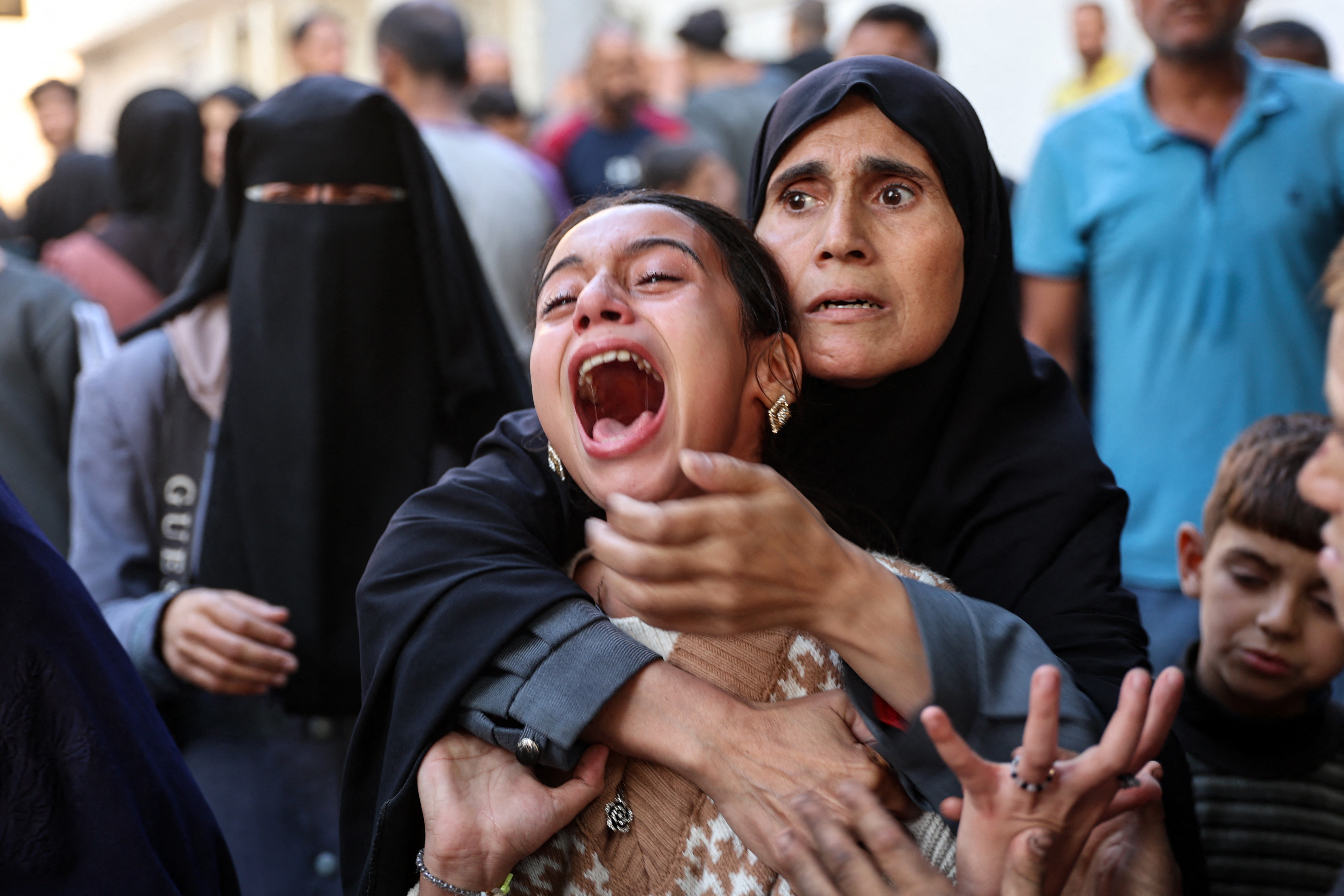 A young Palestinian girl reacts as bodies are transported to the courtyard of the al-Shifa hospital in Gaza City