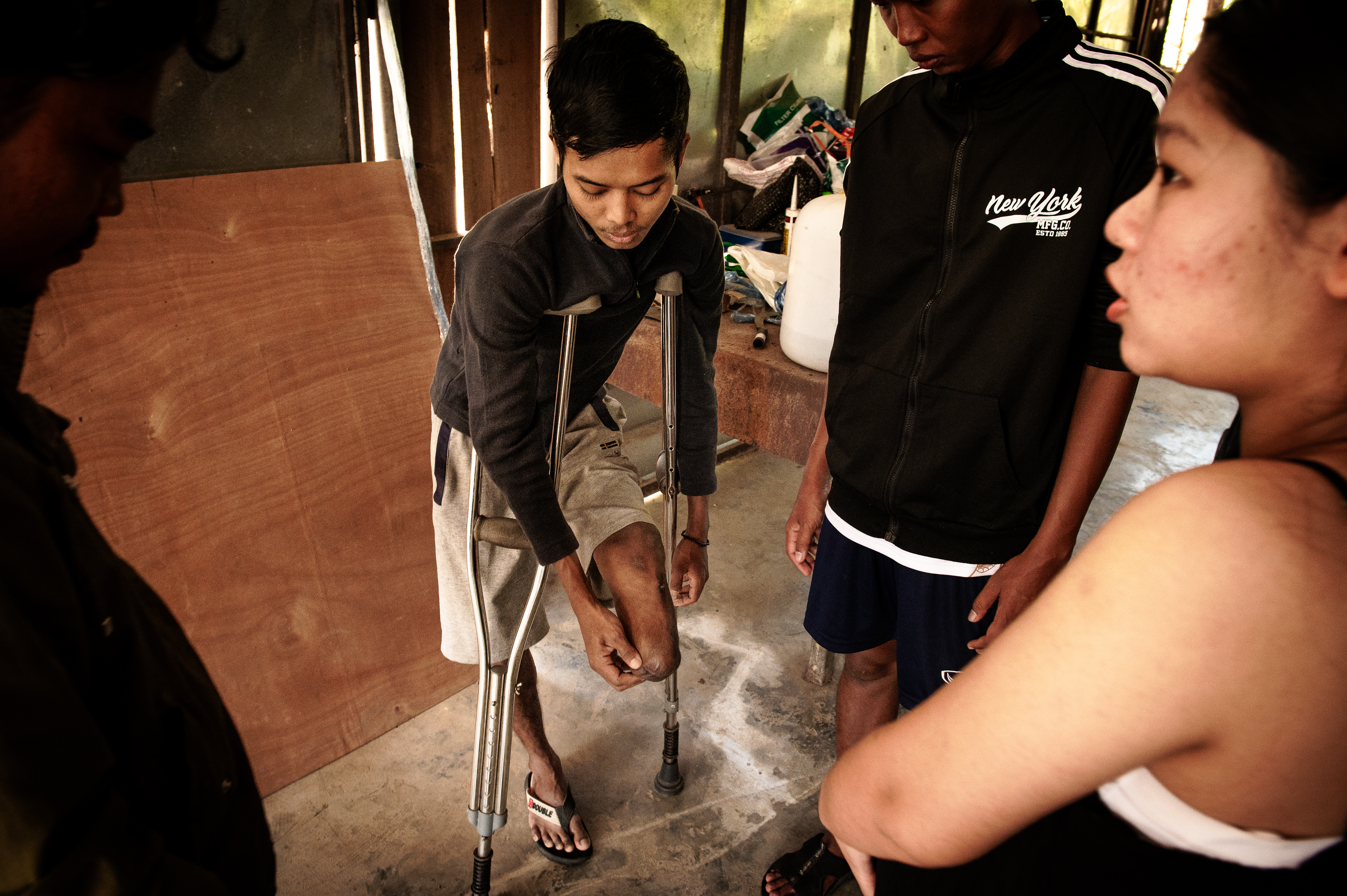 Bo Bo Khant, 23, was a sniper with the Peoples Defence Force. He stepped on a landmine and lost his left leg during a battle with Myanmar's military junta forces [Ali MC/Al Jazeera]