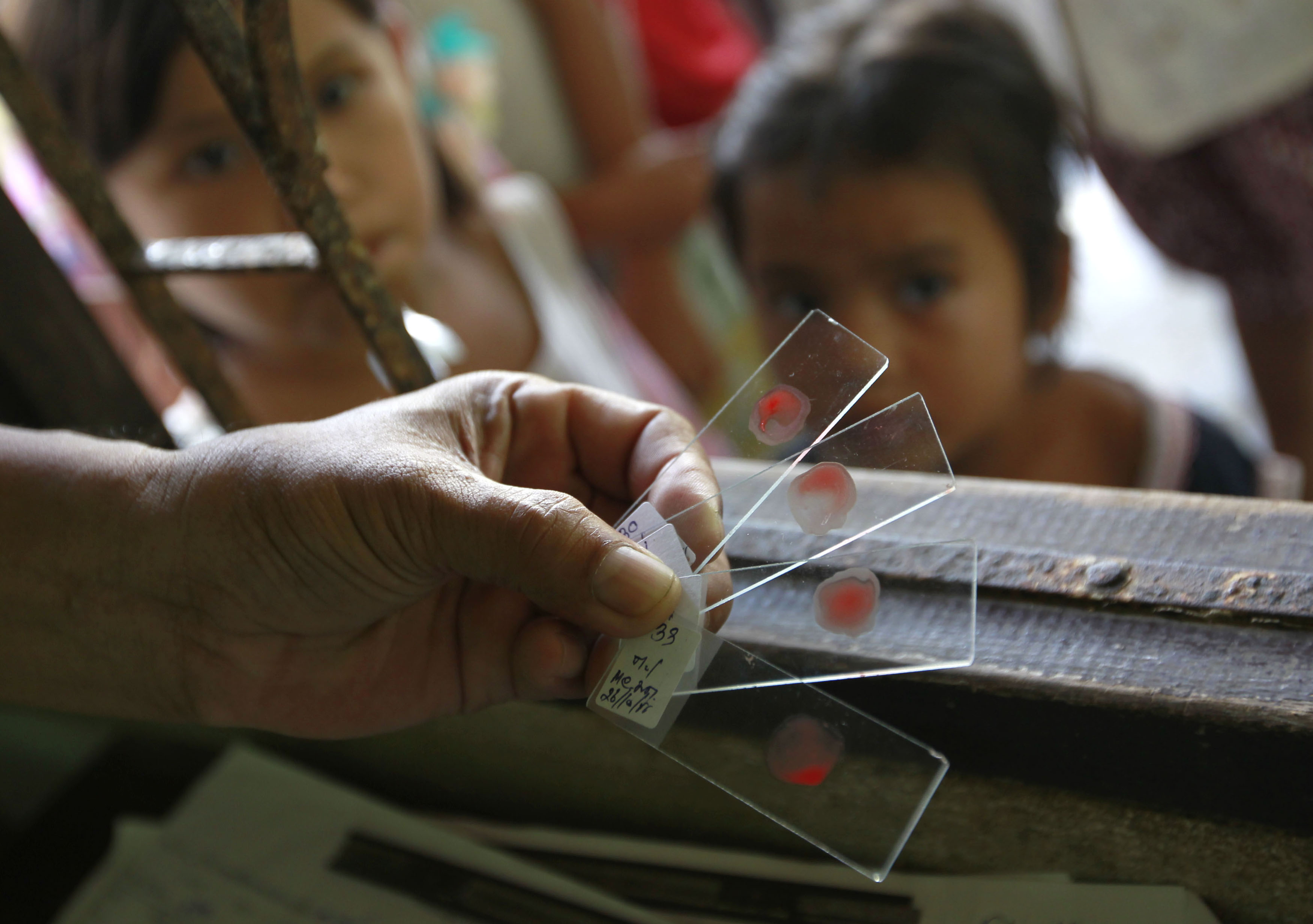 A Ministry of Public Health official holds blood test slides taken from children, who live in the Thai-Myanmar border, at a malaria clinic in the Sai Yoke district, Kanchanaburi Province October 26, 2012. Globally, 3.3 billion people are at risk of malaria infection. While Africa has the highest malaria burden, most the 46,000 deaths outside Africa occurred in Asia Pacific. There are also concerns over a growing parasite resistance. Studies and research show artemisinin-based therapies - currently the most effective treatment against malaria - are taking longer to cure some of the patients. REUTERS/Sukree Sukplang (THAILAND - Tags: POLITICS HEALTH DISASTER)