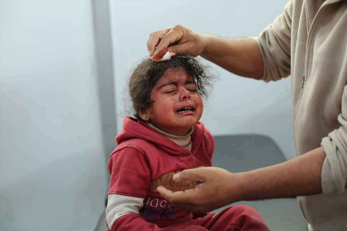 a girl cries as she is treated for a bleeding head wound