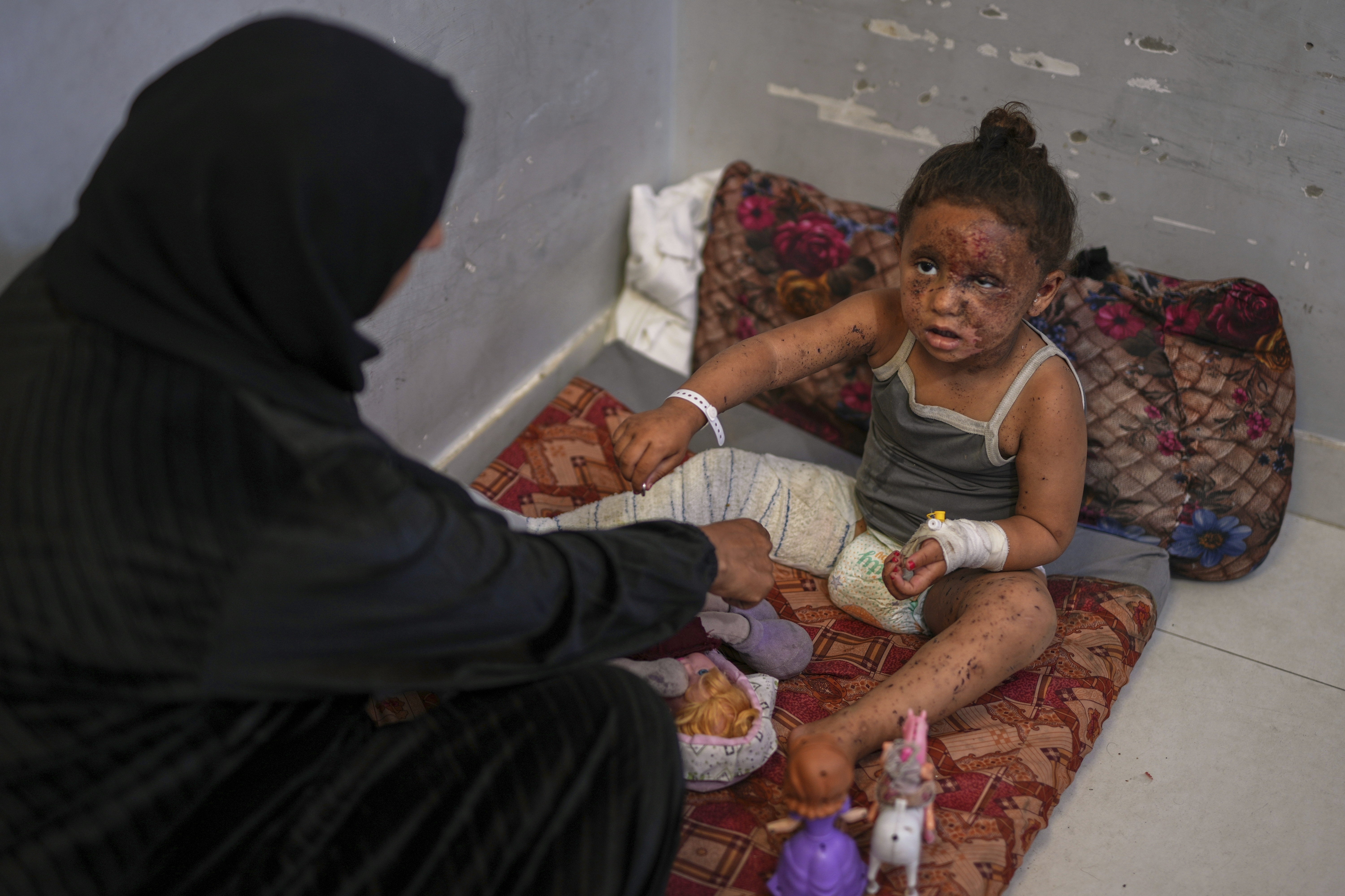 A severely wounded girl sits on a mattress on a concrete floor, with a bandaged leg. She is wearing nappies and a woman is sitting next to her. She has some toys on the mattress near her.