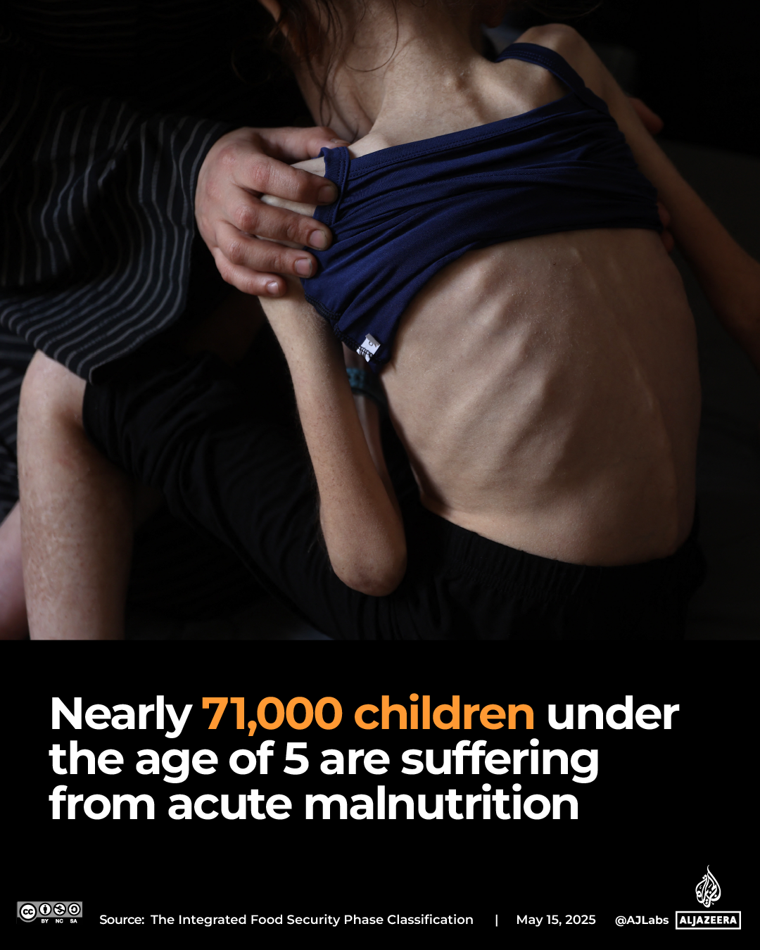 Interactive_Gaza_food_IPC_report_May13_2025-Gaza children acute malnutrition hunger starvation food