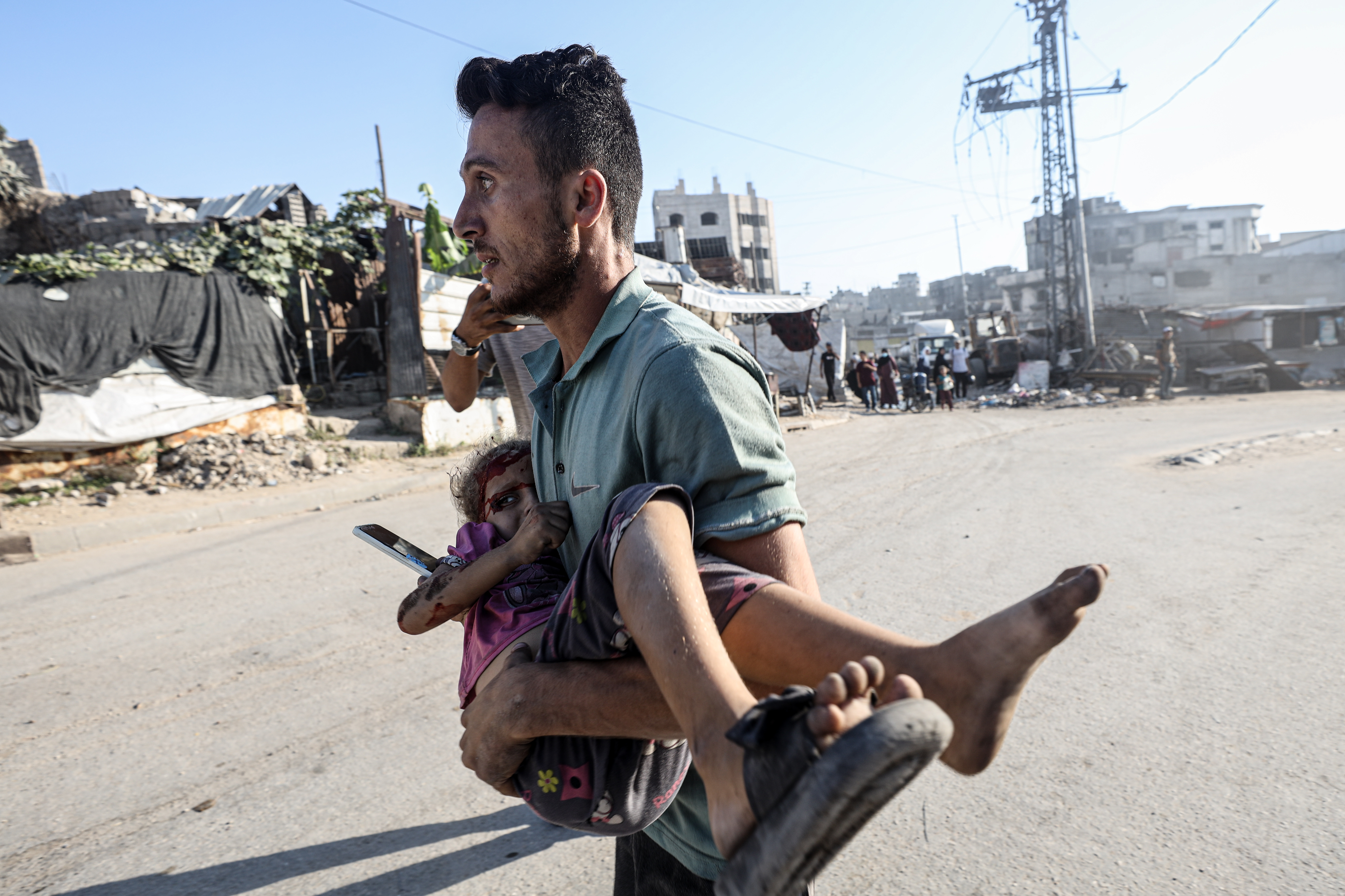 GAZA CITY, GAZA - JULY 23: Injured and deceased Palestinians are brought to the Al-Ahli Baptist Hospital following the Israeli attacks on the Shujaiya neighborhood and near Firas Market in Gaza City, Gaza on July 23, 2025. ( Khames Alrefi - Anadolu Agency )