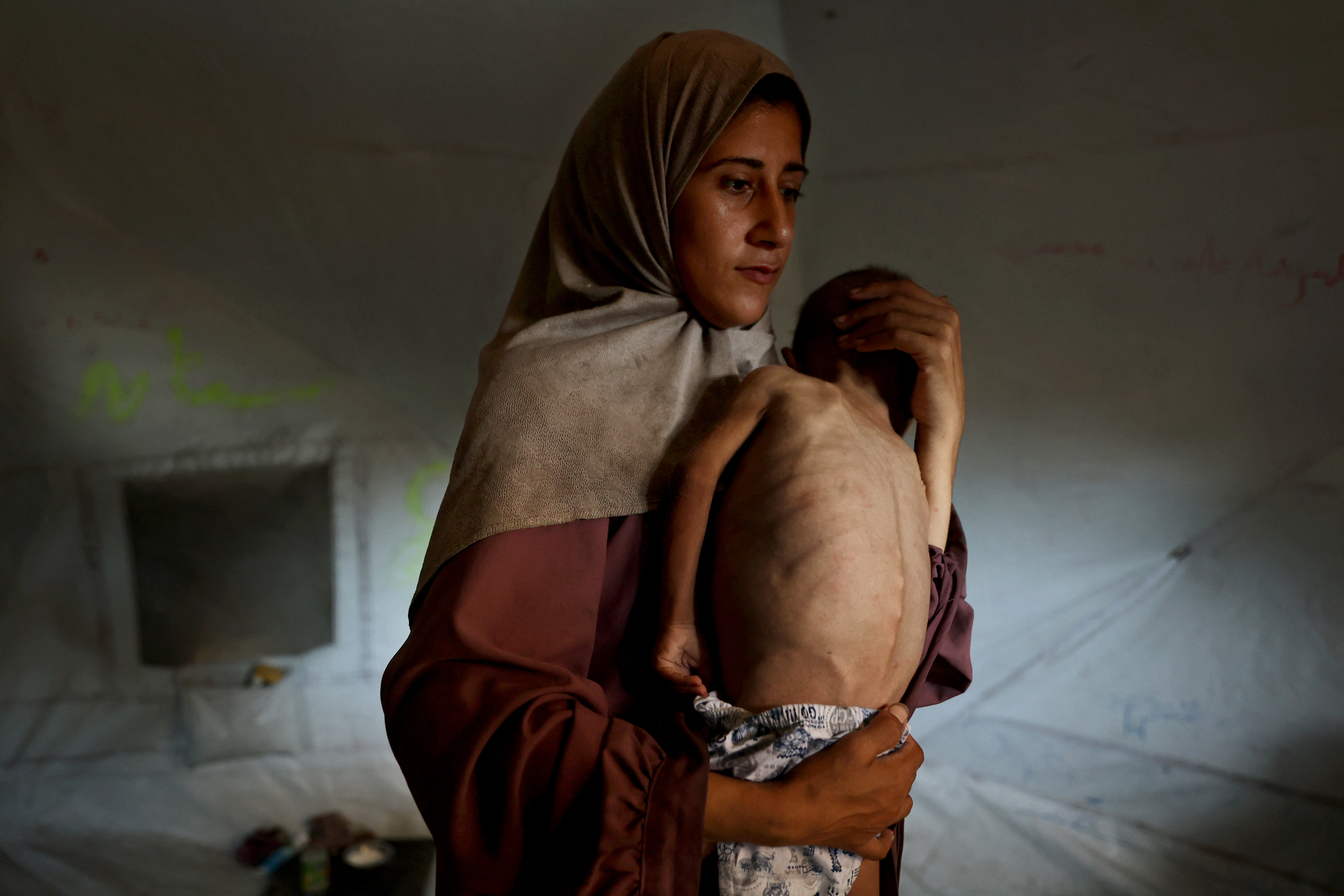 Photos of Gaza's worsening starvation