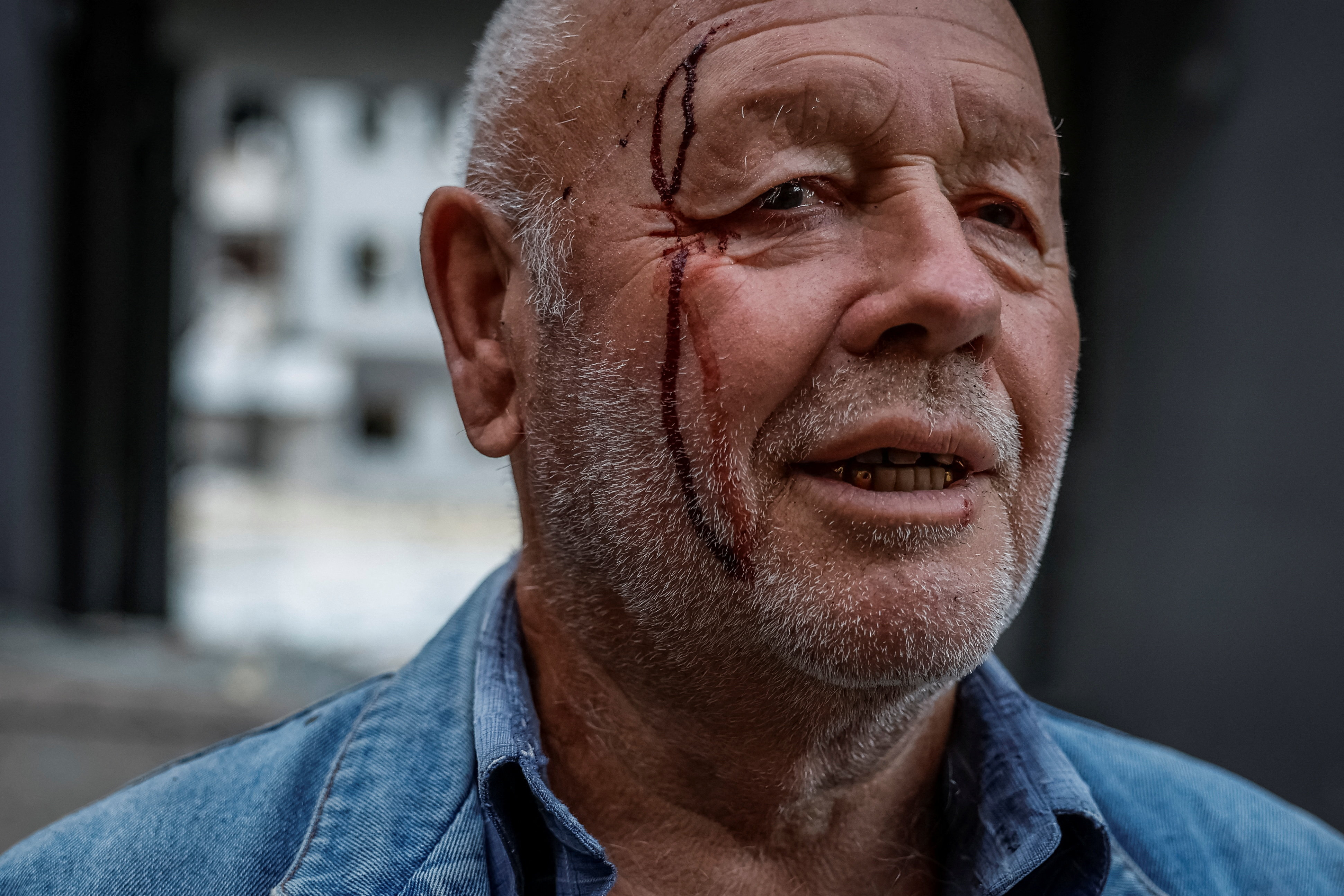 Volodymyr, 76, who was wounded in Russian missile and drone strikes, stands at the site of damaged buildings which were hit, amid Russia's attack on Ukraine, in Kyiv, Ukraine, August 28, 2025. REUTERS/Alina Smutko TPX IMAGES OF THE DAY