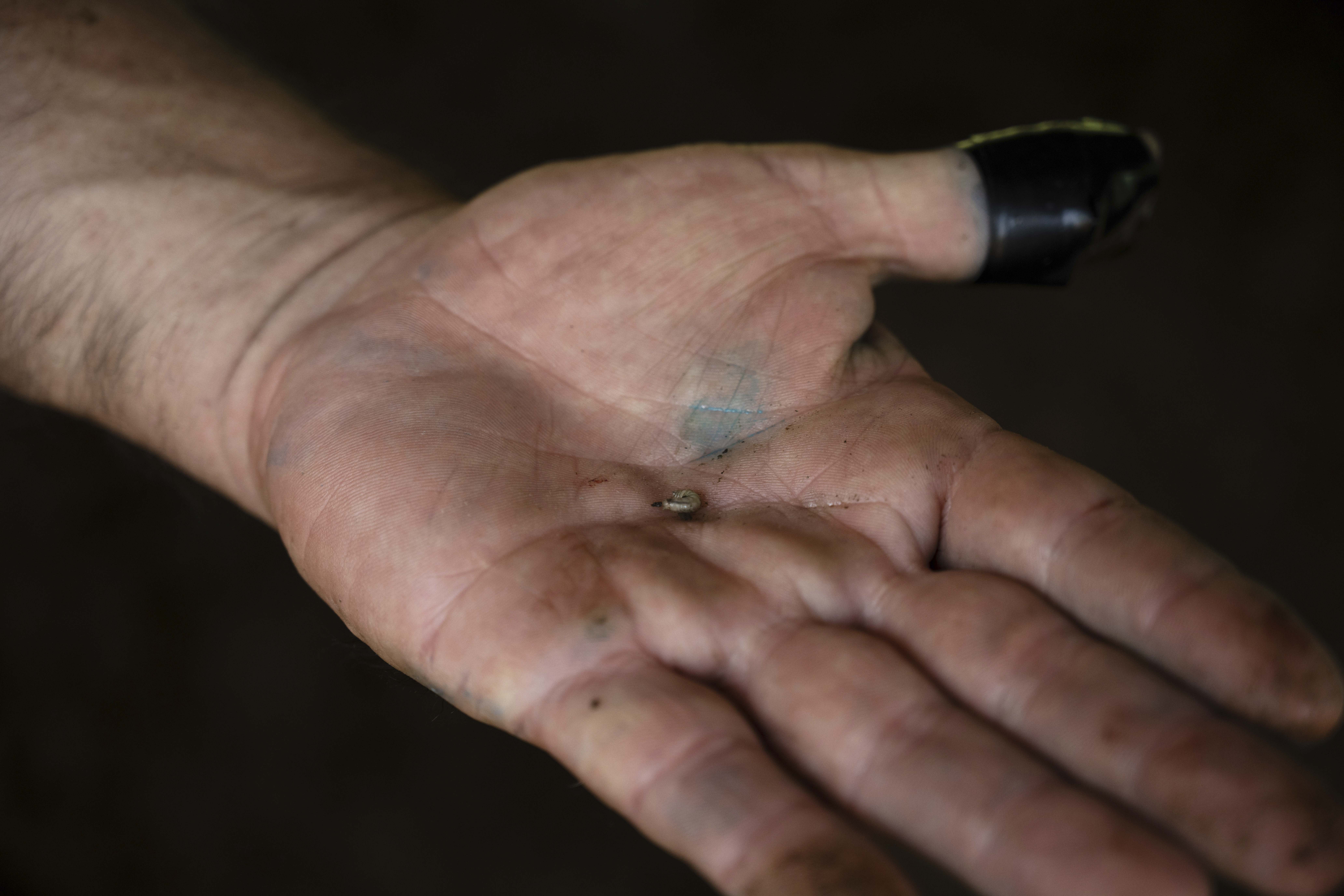 Alfredo Chavez, a cattle rancher and livestock technician, shows New World screwworm larvae removed from a cow at his ranch in Cintalapa, Chiapas, Mexico, Wednesday, July 23, 2025, amid infestation that led the U.S. to suspend cattle imports over fears it could reach the border. (AP Photo/Isabel Mateos)