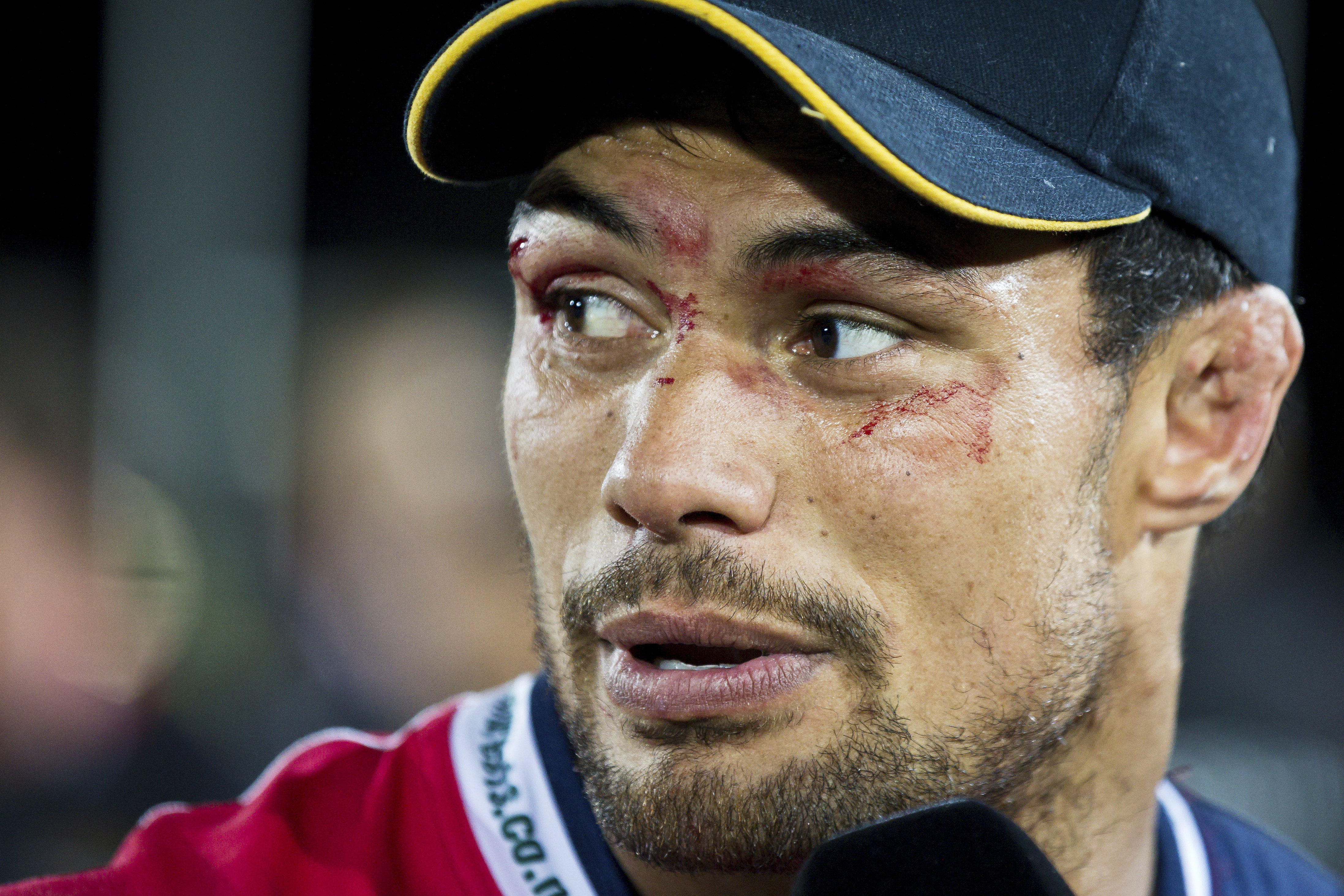 Shane Christie reported several concussions during his playing career [File: Alden Williams/Stuff via AP]