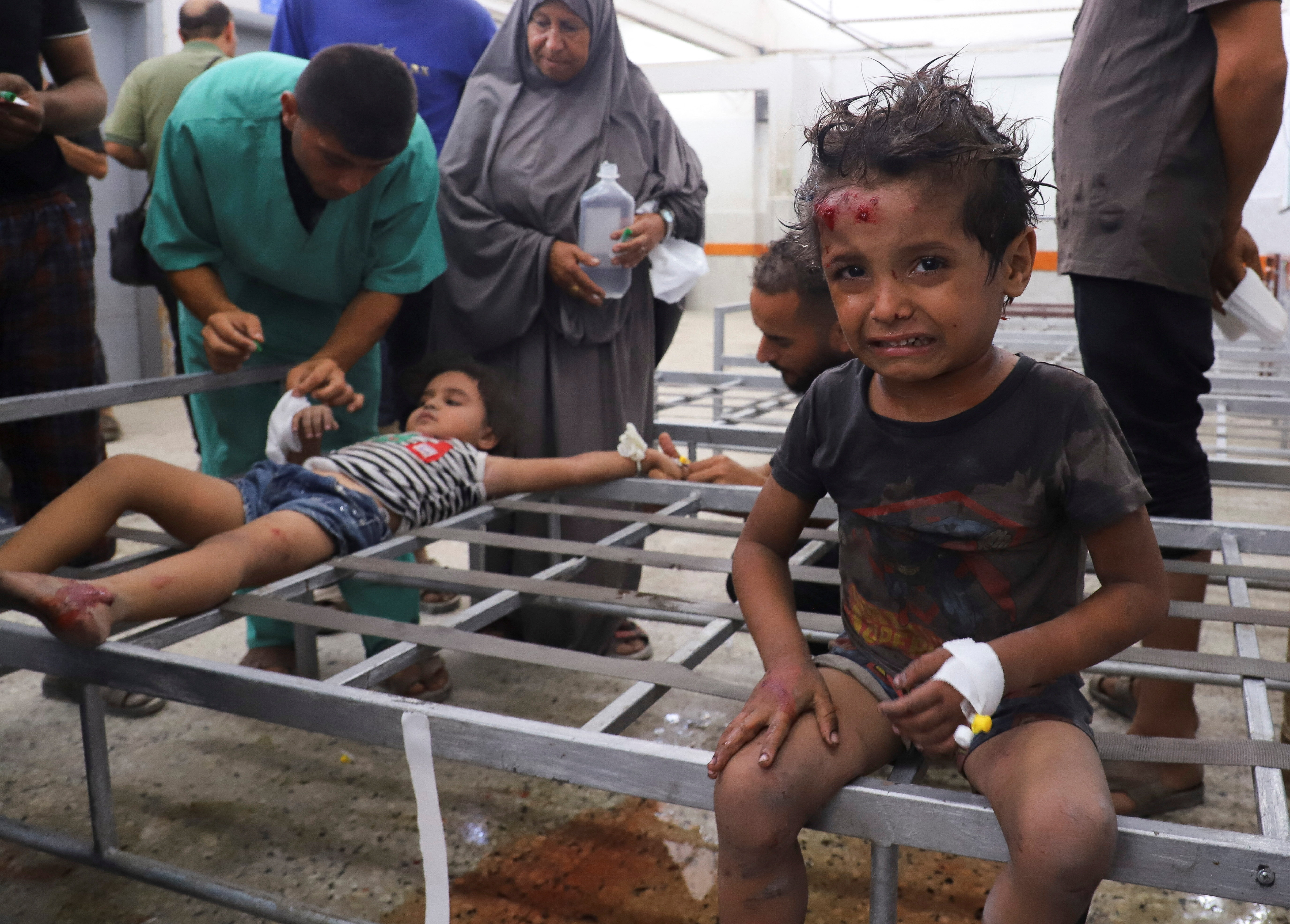 Wounded Palestinians receive treatment at Al-Shifa Hospital