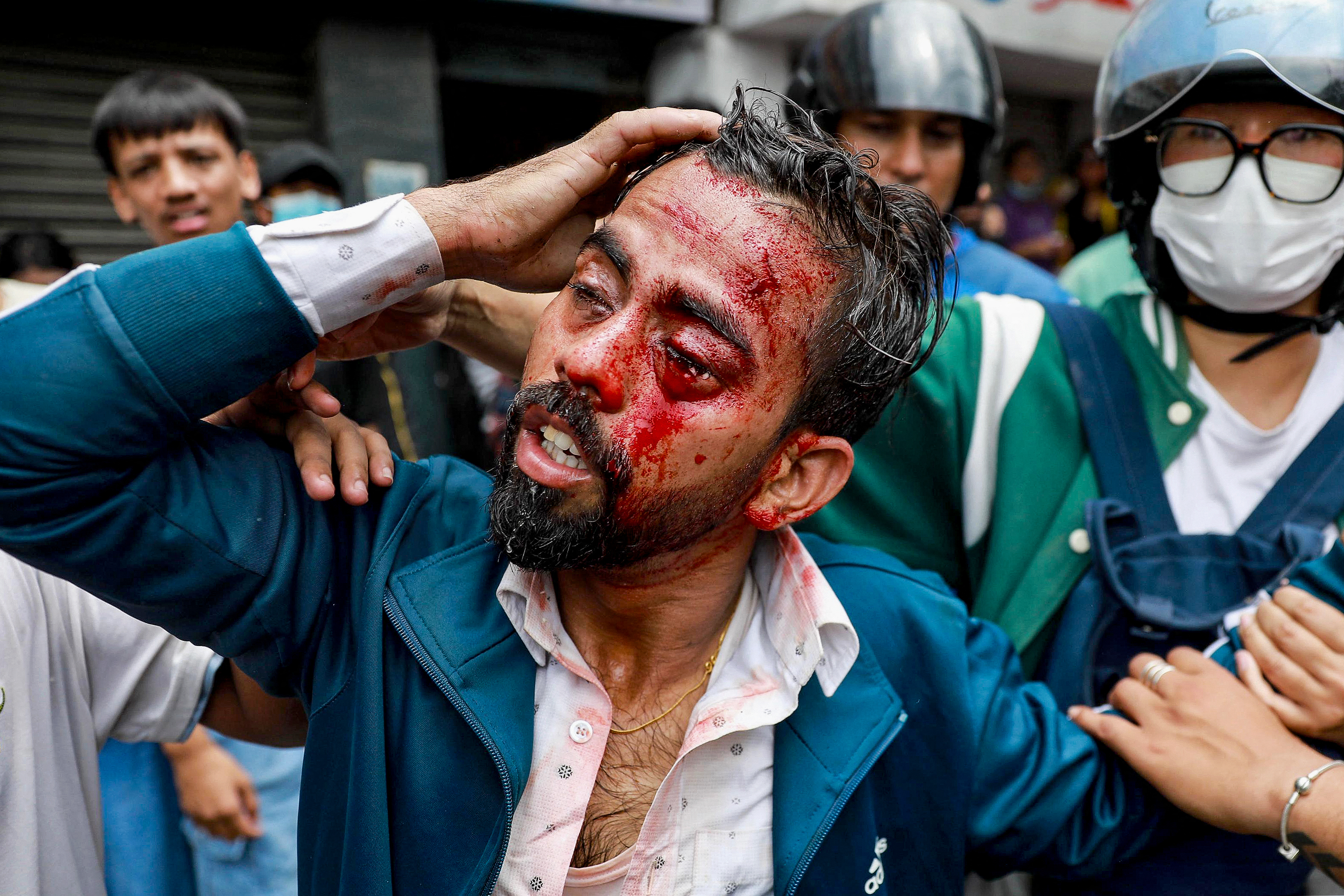 Demonstrators carry an injured victim during a protest outside the Parliament in Kathmandu on September 8, 2025, held to condemn the government over social media prohibitions and corruption.