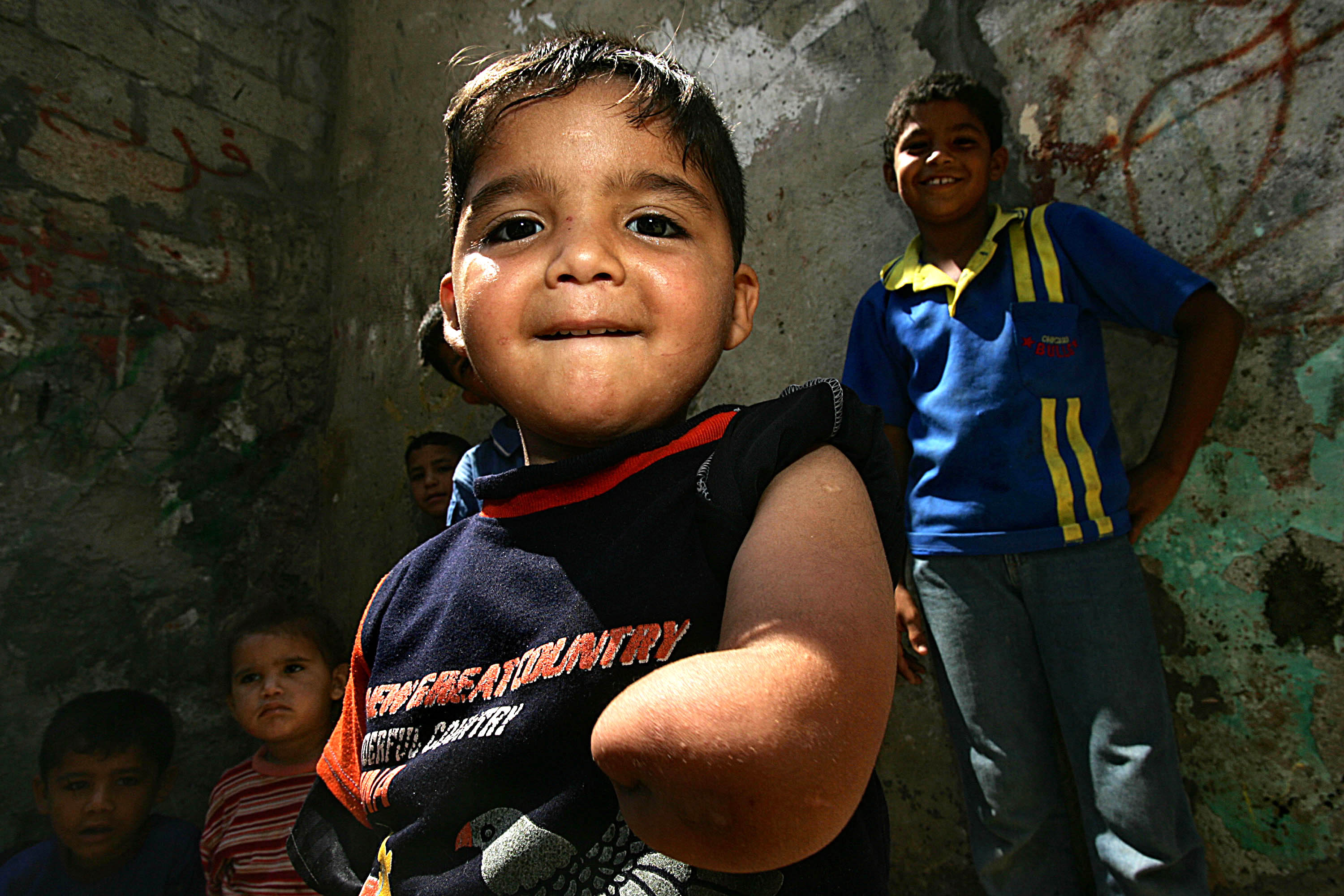 Four-year-old Ahmad Sahlol lost part of his arm when an Israeli tank shelled his family home in Khan Younis